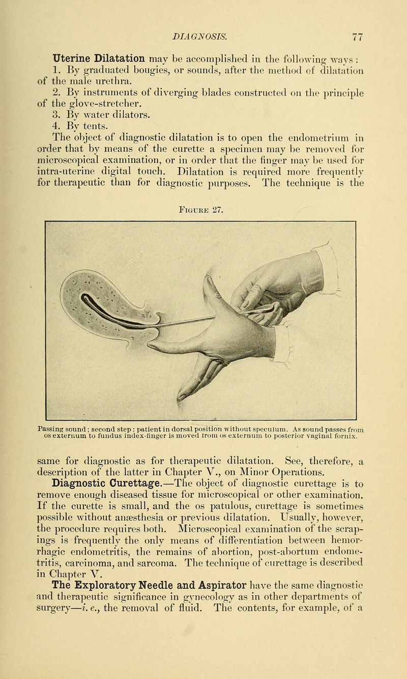 Uterine Dilatation may be accomplished in the following ways: 1. By graduated bougies, or sounds, after the method of dilatation of the male urethra. 2. By instruments of diverging blades constructed on the principle of the glove-stretcher. 3. By water dilators. 4. By tents. The object of diagnostic dilatation is to open the endometrium in order that by means of the curette a specimen may be removed for microscopical examination, or in order that the finger may be used for intra-uterine digital touch. Dilatation is required more frequently for therapeutic than for diagnostic purposes. The technique is the Figure 27. Passing sound; second step : patient in dorsal position without speculum. As sound passes from os externum to fundus index-finger is moved from os externum to posterior vaginal fornix. same for diagnostic as for therapeutic dilatation. See, therefore, a description of the latter in Chapter V., on Minor Operations. Diagnostic Curettage.—The object of diagnostic curettage is to remove enough diseased tissue for microscopical or other examination. If the curette is small, and the os patulous, curettage is sometimes possible without anaesthesia or previous dilatation. Usually, however, the procedure requires both. Microscopical examination of the scrap- ings is frequently the only means of differentiation between hemor- rhagic endometritis, the remains of abortion, post-abortum endome- tritis, carcinoma, and sarcoma. The technique of curettage is described in Chapter V. The Exploratory Needle and Aspirator have the same diagnostic and therapeutic significance in gynecology as in other departments of surgery—i. e., the removal of fluid. The contents, for example, of a