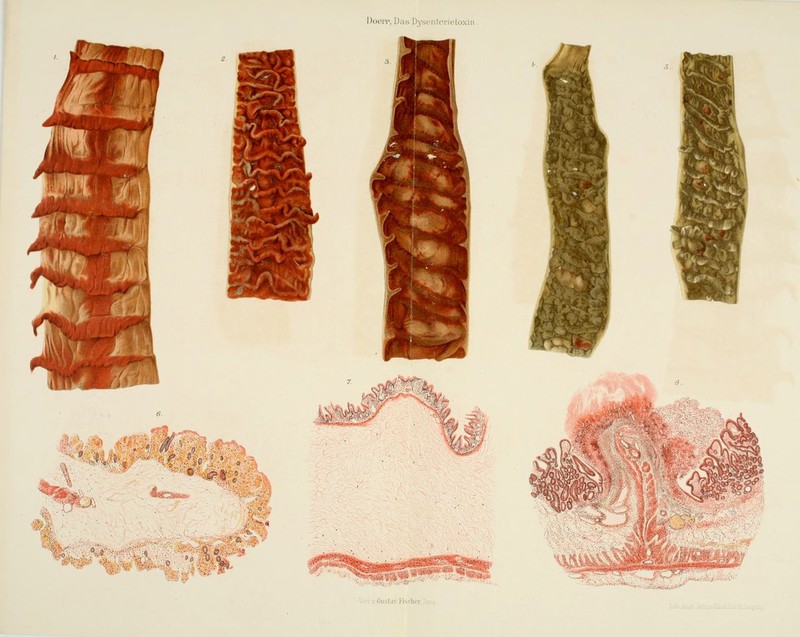 Doei'i-, D;ihi DvsfiilciMi'toxii M *•■€ *^^s^ 3- •4' V'