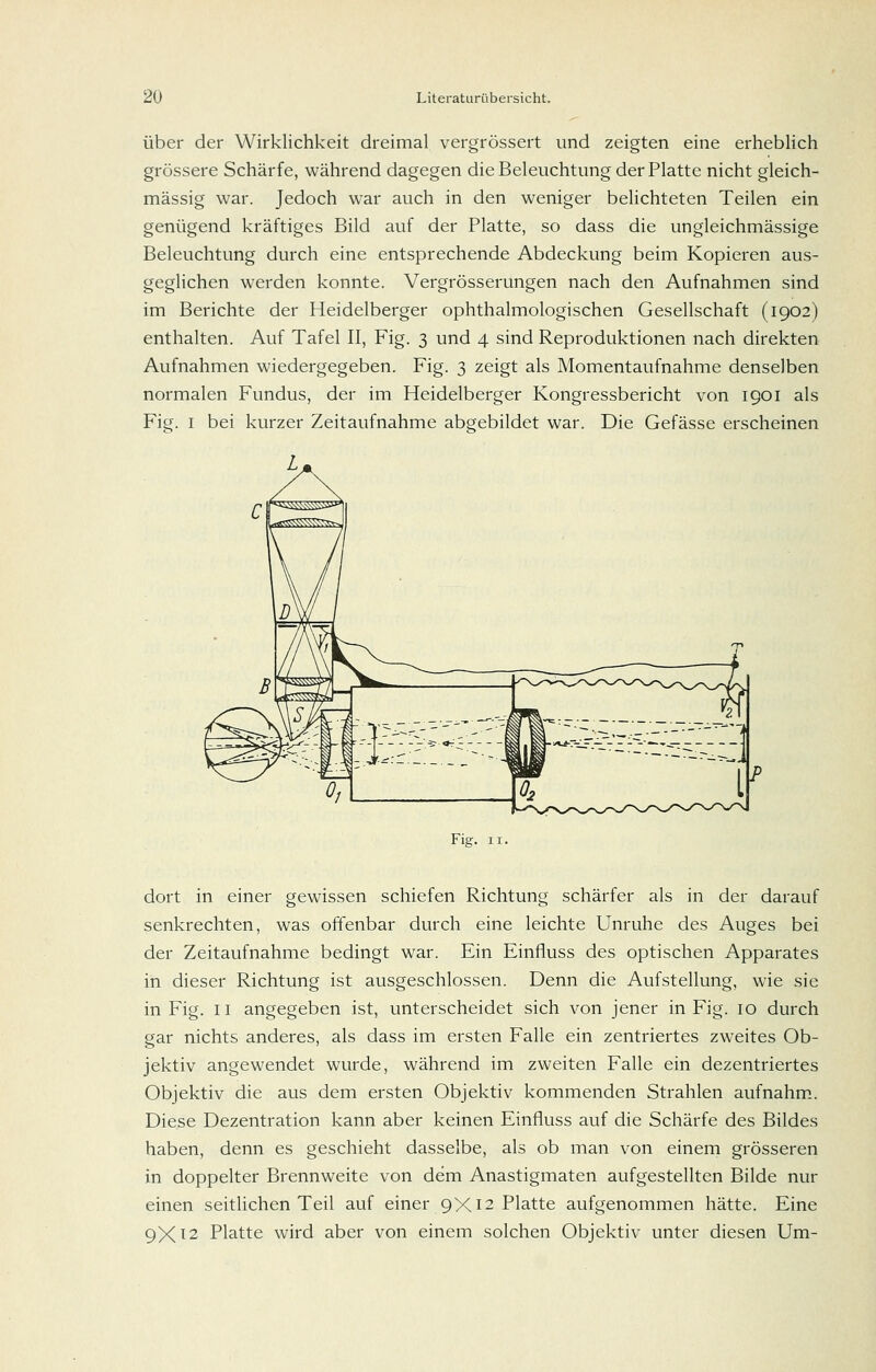 Über der Wirklichkeit dreimal vergrössert und zeigten eine erheblich grössere Schärfe, während dagegen die Beleuchtung der Platte nicht gleich- massig war. Jedoch war auch in den weniger belichteten Teilen ein genügend kräftiges Bild auf der Platte, so dass die ungleichmässige Beleuchtung durch eine entsprechende Abdeckung beim Kopieren aus- geglichen werden konnte. Vergrösserungen nach den Aufnahmen sind im Berichte der Heidelberger ophthalmologischen Gesellschaft (1902) enthalten. Auf Tafel II, Fig. 3 und 4 sind Reproduktionen nach direkten Aufnahmen wiedergegeben. Fig. 3 zeigt als Momentaufnahme denselben normalen Fundus, der im Heidelberger Kongressbericht von 1901 als Fig. I bei kurzer Zeitaufnahme abgebildet war. Die Gefässe erscheinen Fig. II. dort in einer gewissen schiefen Richtung schärfer als in der darauf senkrechten, was olTenbar durch eine leichte Unruhe des Auges bei der Zeitaufnahme bedingt war. Ein Einfluss des optischen Apparates in dieser Richtung ist ausgeschlossen. Denn die Aufstellung, wie sie in Fig. II angegeben ist, unterscheidet sich von jener in Fig. 10 durch gar nichts anderes, als dass im ersten Falle ein zentriertes zweites Ob- jektiv angewendet wurde, während im zweiten Falle ein dezentriertes Objektiv die aus dem ersten Objektiv kommenden Strahlen aufnahm. Diese Dezentration kann aber keinen Einfluss auf die Schärfe des Bildes haben, denn es geschieht dasselbe, als ob man von einem grösseren in doppelter Brennweite von dem Anastigmaten aufgestellten Bilde nur einen seitlichen Teil auf einer 9X12 Platte aufgenommen hätte. Eine 9X^2 Platte wird aber von einem solchen Objektiv unter diesen Um-