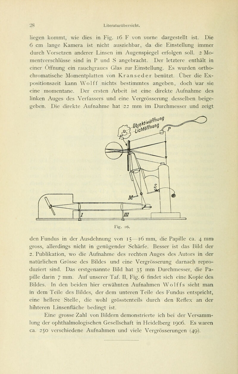 liegen kommt, wie dies in Fig. i6 F von vorne dargestellt ist. Die 6 cm lange Kamera ist nicht ausziehbar, da die Einstellung immer durch Vorsetzen anderer Linsen im Augenspiegel erfolgen soll. 2 Mo- mentverschlüsse sind in P und S angebracht. Der letztere enthält in einer Öffnung ein rauchgraues Glas zur Einstellung. Es wurden ortho- chromatische Momentplatten von Kranseder benützt. Über die Ex- positionszeit kann Wolff nichts bestimmtes angeben, doch war sie eine momentane. Der ersten Arbeit ist eine direkte Aufnahme des linken Auges des Verfassers und eine Vergrösserung desselben beige- geben. Die direkte Aufnahme hat 22 mm im Durchmesser und zeigt Fig. 16. den Fundus in der Ausdehnung von 15—16 mm, die Papille ca. 4 mmi gross, allerdings nicht in genügender Schärfe. Besser ist das Bild der 2. Publikation, wo die Aufnahme des rechten Auges des Autors in der natürlichen Grösse des Bildes und eine Vergrösserung darnach repro- duziert sind. Das erstgenannte Bild hat 35 mm Durchmesser, die Pa- pille darin 7 mm. Auf unserer Taf. II, Fig. 6 findet sich eine Kopie des Bildes. In den beiden hier erwähnten Aufnahmen Wolffs sieht man in dem Teile des Bildes, der dem unteren Teile des Fundus entspricht, eine hellere Stelle, die wohl grösstenteils durch den Reflex an der hinteren Linsenfiäche bedingt ist. Eine grosse Zahl von Bildern demonstrierte ich bei der Versamm- lung der ophthalmologischen Gesellschaft in Heidelberg 1906. Es waren ca. 250 verschiedene Aufnahmen und viele Vergrösserungen (49).