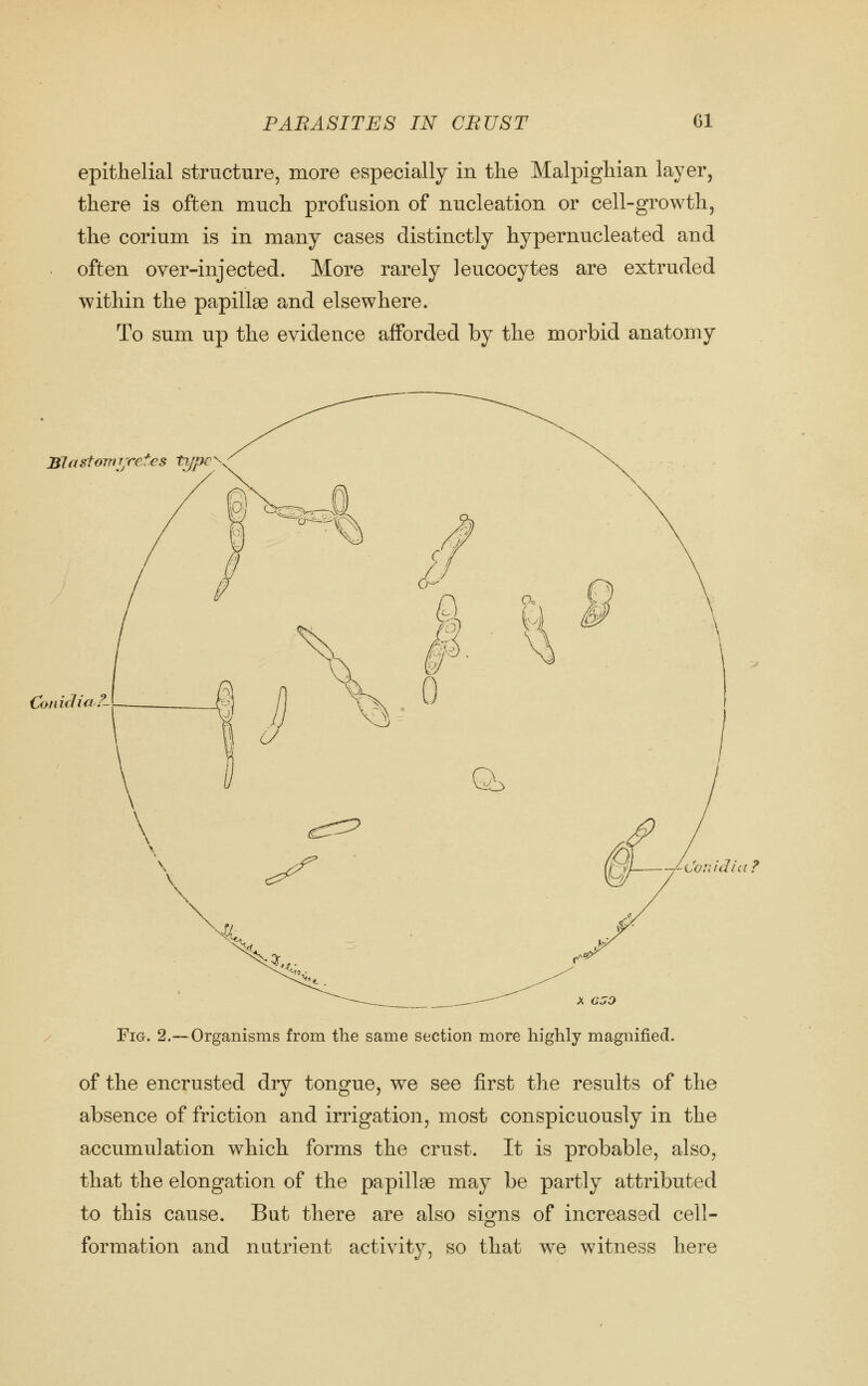 epithelial structure, more especially in the Malpighian layer, there is often much profusion of nucleation or cell-growth, the corium is in many cases distinctly hypernucleated and often over-injected. More rarely leucocytes are extruded within the papillae and elsewhere. To sum up the evidence afforded by the morbid anatomy Bletsfojrijretes type Coniflui.''- -/-donidia? Fig. 2.—Organisms from the same section more highly magnified. of the encrusted dry tongue, we see first the results of the absence of friction and irrigation, most conspicuously in the accumulation which forms the crust. It is probable, also, that the elongation of the papillae may be partly attributed to this cause. But there are also signs of increased cell- formation and nut.rient activity, so that we witness here