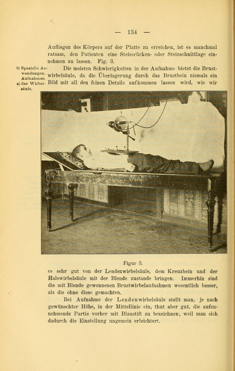 Aufliegen des Körpers auf der Platte zu erreichen, ist es manchmal ratsam, den Patienten eine Steissrücken- oder Steinschnittlage ein- nehmen zu lassen. Fig. 3. 9) Spezielle An- Die meisten Schwierigkeiten in der Aufnahme bietet die Brust- wendmigen. ^irbelsäule, da die Überlagerung durch das Brustbein niemals ein a) der Wirbel- Bild mit all den feinen Details aufkommen lassen wird, wie wir säale. Eigur 3. es sehr gut von der Lendenwirbelsäule, dem Kreuzbein und der Halswirbelsäule mit der Blende zustande bringen. Immerhin sind die mit Blende gewonnenen Brustwirbelaufnahmen wesentlich besser, als die ohne diese gemachten. Bei Aufnahme der Lenden Wirbelsäule stellt man, je nach gewünschter Höhe, in der Mittellinie ein, thut aber gut, die aufzu- nehmende Partie vorher mit Blaustift zu bezeichnen, weil man sich dadurch die Einstellung ungemein erleichtert.