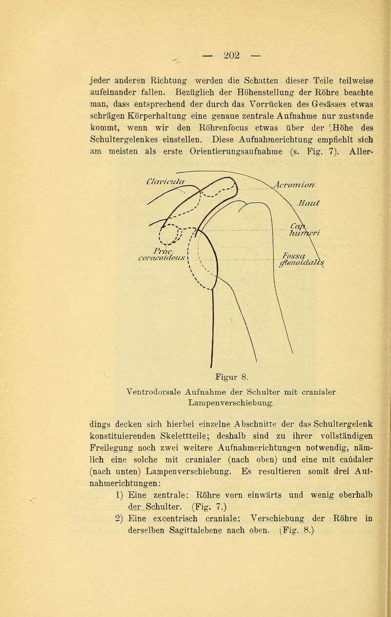 jeder anderen Richtung werden die Schatten dieser Teile teilweise aufeinander fallen. Bezüglich der Höhenstellung der Röhre beachte man, dass entsprechend der durch das Vorrücken desGesässes etwas schrägen Körperhaltung eine genaue zentrale Aufnahme nur zustande kommt, wenn wir den Röhrenfocus etwas über der !.Höhe des Schultergelenkes einstellen. Diese Aufnahraerichtung empfiehlt sich am meisten als erste Orientierungsaufnahme (s. Fig. 7). Aller- Claricizla Acromiorv Haut Pröc. , 1 coraroideiis t Figur 8. Ventrodorsale Aufnahme der Schulter mit cranialer Lampenverschiebung. dings decken sich hierbei einzelne Abschnitte der das Schultergelenk konstituierenden Skelettteile; deshalb sind zu ihrer vollständigen Freilegung noch zwei weitere Aufnahmerichtungen notwendig, näm- lich eine solche mit cranialer (nach oben) und eine mit caüdaler (nach unten) Lampenverschiebung. Es resultieren somit drei Auf- nahmerichtungen : 1) Eine zentrale: Röhre vorn einwärts und wenig oberhalb der.Schulter. (Fig. 7.) 2) Eine excentrisch craniale; Verschiebung der Röhre in derselben Sagittalebene nach oben. (Fig. 8.)