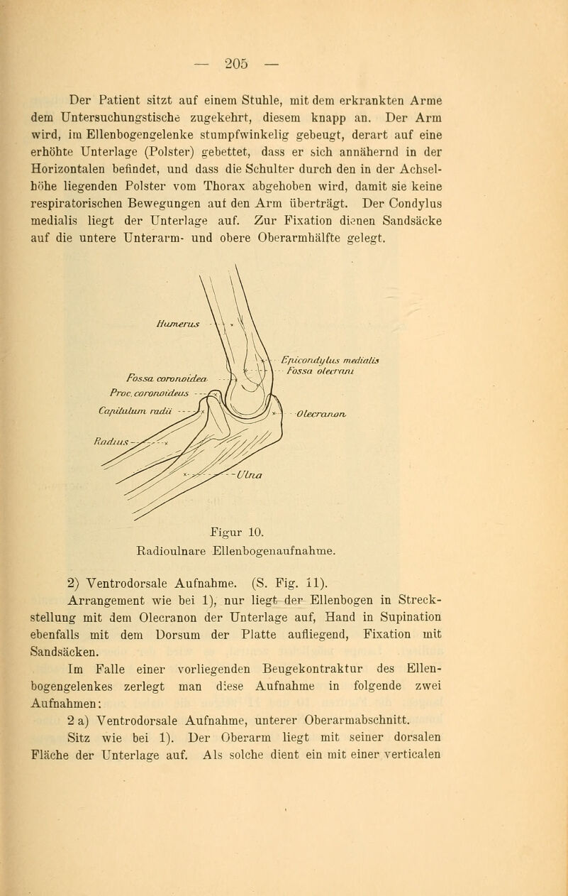 Der Patient sitzt auf einem Stuhle, mit dem erlirankten Arme dem Untersuchungstischc zugekehrt, diesem knapp an. Der Arm wird, im Ellenbogengelenke stumpfwinkelig gebeugt, derart auf eine erhöhte Unterlage (Polster) gebettet, dass er sich annähernd in der Horizontalen befindet, und dass die Schulter durch den in der Achsel- höhe liegenden Polster vom Thorax abgehoben wird, damit sie keine respiratorischen Bewegungen auf den Arm überträgt. Der Condylus medialis liegt der Unterlage auf. Zur Fixation dienen Sandsäcke auf die untere Unterarm- und obere Oberarmhälfte gelegt. FosscL cororwidea, Proc. cororwüLeus Cafuütlujn. radü —y^f. | RndjAis - EfiicoruiyUis medialis Fossa oieurruu OLecraiton. Figur 10. Radioiilnare EUenbogenaufnalime. 2) Ventrodorsale Aufnahme. (S. Fig. 11). Arrangement wie bei 1), nur liegt der Ellenbogen in Streck- stellung mit dem Olecranon der Unterlage auf, Hand in Supination ebenfalls mit dem Dorsum der Platte aufliegend, Fixation mit Sandsäcken. Im Falle einer vorliegenden Beugekontraktur des Ellen- bogengelenkes zerlegt man diese Aufnahme in folgende zwei Aufnahmen: 2 a) Ventrodorsale Aufnahme, unterer Oberarmabschnitt. Sitz wie bei 1). Der Oberarm liegt mit seiner dorsalen Fläche der Unterlage auf. Als solche dient ein mit einer verticalen