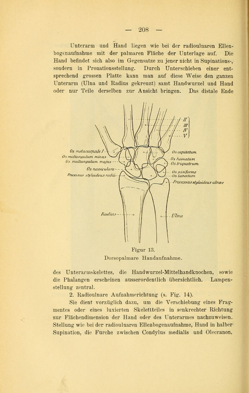 Unterarm und Hand liegen wie bei der radioulnaren Ellen- bogenaufnahme mit der palmaren Fläche der Unterlage auf. Die Hand befindet sich also im Gegensatze zu jener nicht in Supinations-, sondern in Pronationsstellung. Durch Unterschieben einer ent- sprechend grossen Platte kann man auf diese Weise den ganzen Unterarm (Ulna und Radius gekreuzt) samt Handwurzel und Hand oder nur Teile derselben zur Ansicht bringen. Das distale Ende Os tneiacarjLale /- Osmultanpuhim. minus-- Os mullangiUum. mq/us - Os ruwiculare-- frocessus sfyliiideiLS radii- Processas sUfloidciLS u/nae RadÜLs- Figur 13. Dorsopalmare Handauf nähme. des Unterarmskelettes, die Handwurzel-Mittelhandknochen, sowie die Phalangen erscheinen ausserordentlich übersichtlich. Lampen- stellung zentral. 2. Radioulnare Aufnahmerichtung (s. Fig. 14). Sie dient vorzüglich dazu, um die Verschiebung eines Frag- mentes oder eines luxierten Skelettteiles in senkrechter Richtung zur Flächendimension der Hand oder des Unterarmes nachzuweisen. Stellung wie bei der radioulnaren Ellenbogenaufnahme, Hand in halber Supination, die Furche zwischen Condylus medialis und Olecranon,