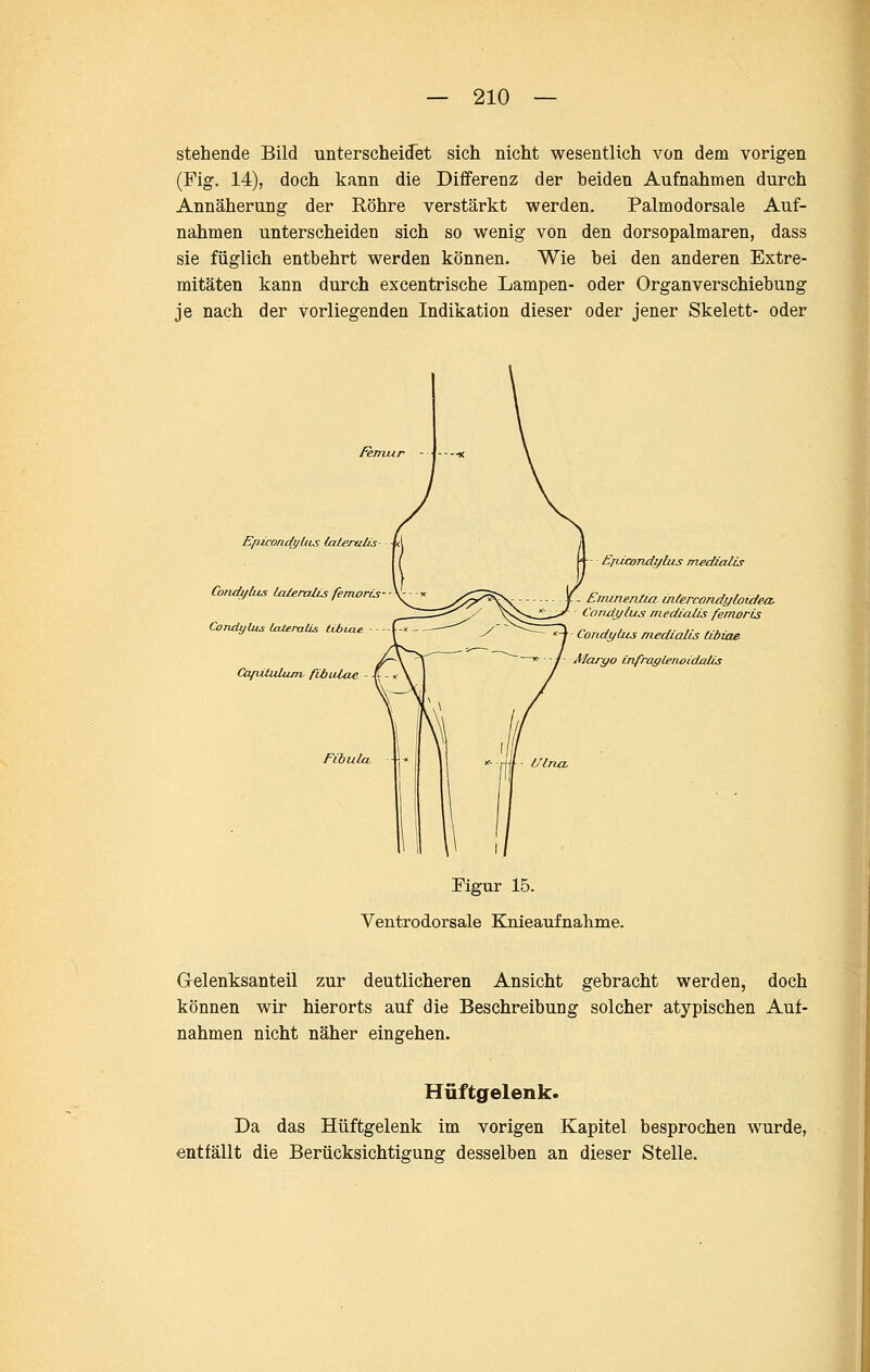 stehende Bild unterscheidet sich nicht wesentlich von dem vorigen (Fig. 14), doch kann die Differenz der beiden Aufnahmen durch Annäherung der Röhre verstärkt werden. Palmodorsale Auf- nahmen unterscheiden sich so wenig von den dorsopalmaren, dass sie füglich entbehrt werden können. Wie bei den anderen Extre- mitäten kann durch excentrische Lampen- oder Organverschiebung je nach der vorliegenden Indikation dieser oder jener Skelett- oder femur Ep-ürondt/ltLs (ateraUs- Cbndijkis Lalerahs femoris CondyUis UUemlis libiae ■ - CapltuUun, fibulae - Fibula. EfucoTidylus medialis - Enunen/ia. intercondyloidea, Condj/lus medialis femoris Condylus medialis tibiae Alarc/o infraglenoidMis - Ulna, Figur 15. Ventrodorsale Eöueaufnalime. Grelenksanteil zur deutlicheren Ansicht gebracht werden, doch können wir hierorts auf die Beschreibung solcher atypischen Auf- nahmen nicht näher eingehen. Hüftgelenk. Da das Hüftgelenk im vorigen Kapitel besprochen wurde, entfällt die Berücksichtigung desselben an dieser Stelle.