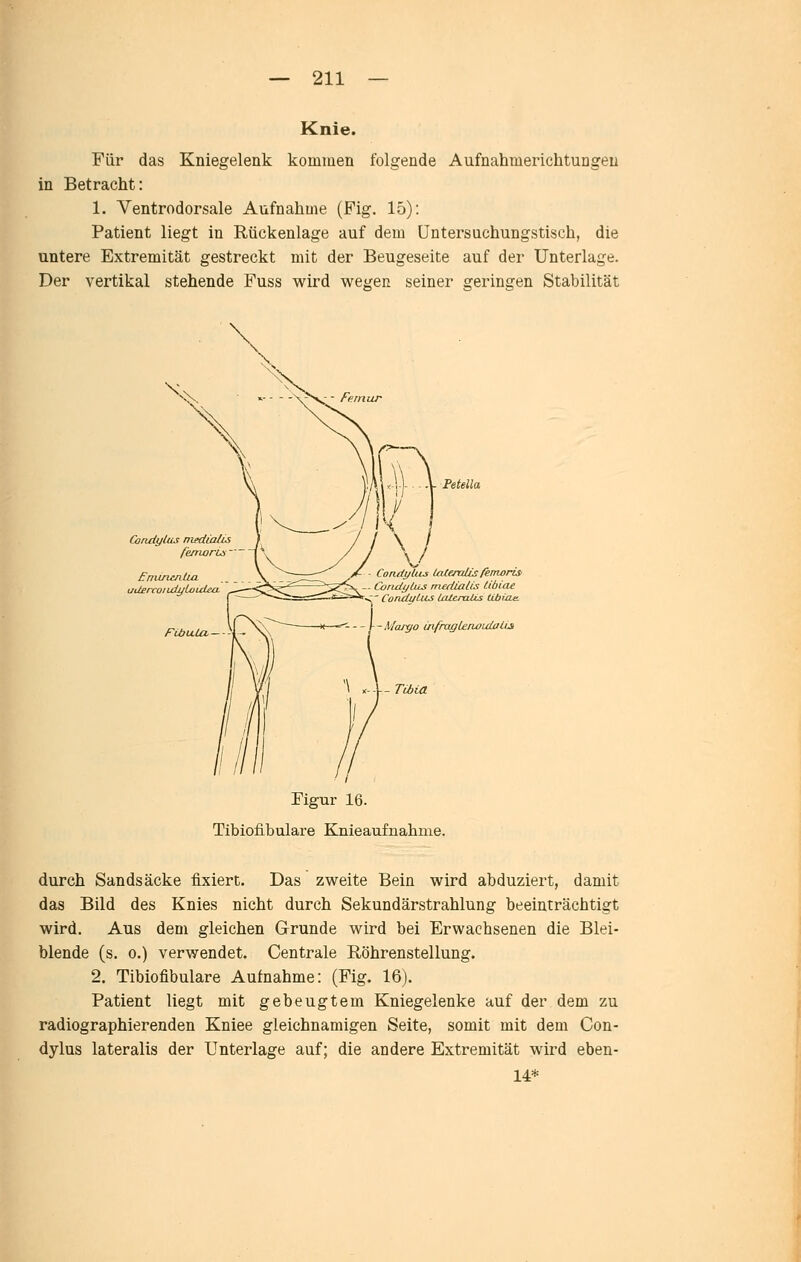 Knie. Für das Kniegelenk kommen folgende Aufnahmerichtungeu in Betracht: 1. Ventrodorsale Aufnahme (Pig, 15): Patient liegt in Rückenlage auf dem Untersuchungstisch, die untere Extremität gestreckt mit der Beugeseite auf der Unterlage. Der vertikal stehende Fuss wird wehren seiner sreringen Stabilität CoruiyUis msdiaUs /'emorui ' ■ EnunxnlUL uilercot idi/to uLea. 'Peteila \J Condi/lus Uilendis fenwrisi CondijäLS rnedialis tibCae ' Condytiis Lateralis lUbicie. Margo mfraglenotxiaitji Figur 16. Tibiofibulare Knieaufnahnie. durch Sandsäcke fixiert. Das zweite Bein wird abduziert, damit das Bild des Knies nicht durch Sekundärstrahlung beeinträchtigt wird. Aus dem gleichen Grunde wird bei Erwachsenen die Blei- blende (s. 0.) verwendet. Centrale Röhrenstellung. 2. Tibiofibulare Aufnahme: (Fig. 16). Patient liegt mit gebeugtem Kniegelenke auf der dem zu radiographierenden Kniee gleichnamigen Seite, somit mit dem Con- dylus lateralis der Unterlage auf; die andere Extremität wird eben- 14*