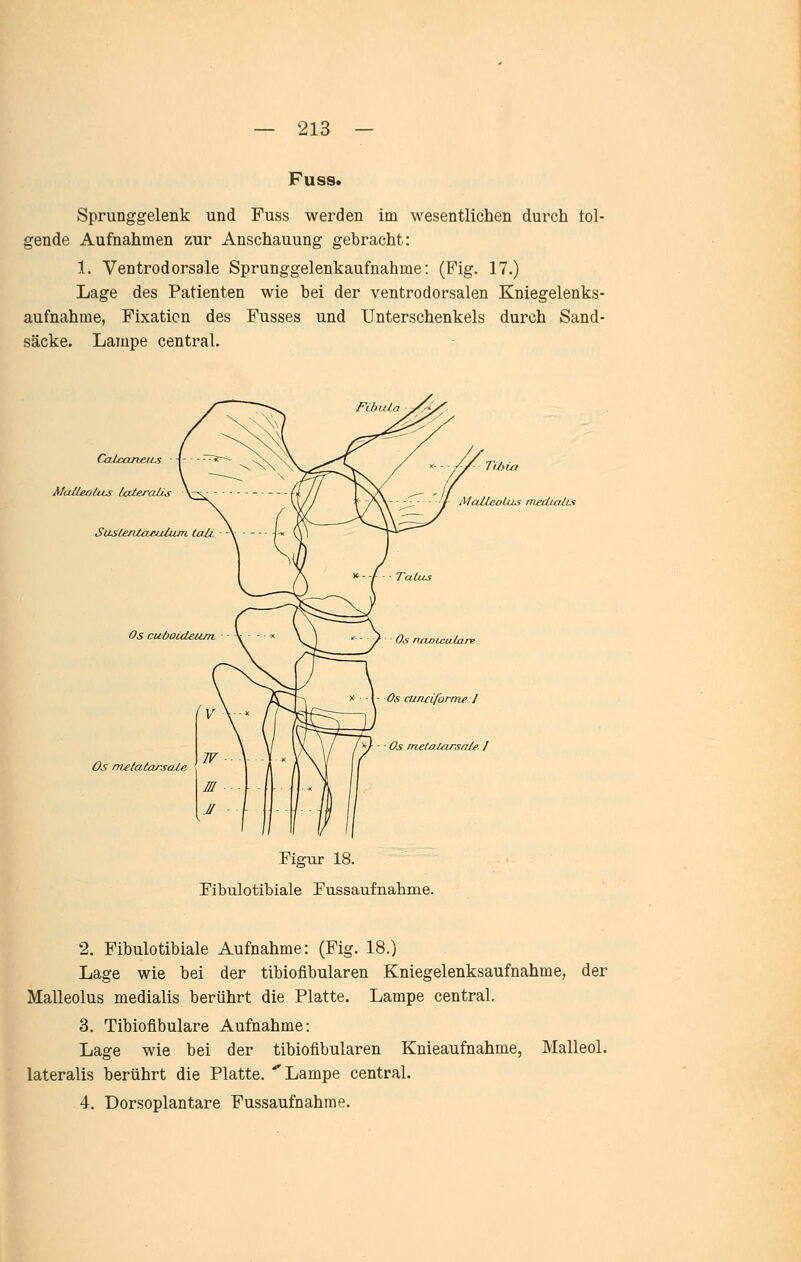 Fuss. Sprunggelenk und Fuss werden im wesentlichen durch tol- gende Aufnahmen zur Anschauung gebracht: 1. Ventrodorsale Sprunggelenkaufnahme: (Fig. 17.) Lage des Patienten wie bei der ventrodorsalen Kniegelenks- aufnahme, Fixation des Fusses und Unterschenkels durch Sand- säcke. Lampe central. ru>üi MaUeolus mediaiut Os ncioiculare Os cuncLforme l Os irtetaUirsaJe l Os metaUirsale Figur 18. Fibulotibiale Fussaufnaliine. 2. Fibulotibiale Aufnahme: (Fig. 18.) Lage wie bei der tibiofibularen Kniegelenksaufnahme, der Malleolus medialis berührt die Platte. Lampe central, 3. Tibiofibulare Aufnahme: Lage wie bei der tibiofibularen Knieaufnahme, Malleol. lateralis berührt die Platte. ''Lampe central. 4. Dorsoplantare Fussaufnahme.