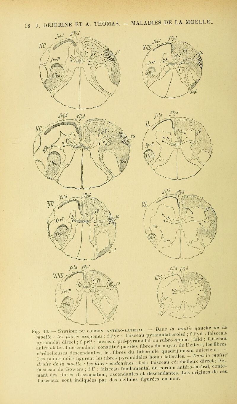 Fig. 13. - S.STKH. DU connoN A^•TÉRO-LATÉuAL. - Dausla '«^^'„«,f^f/^;.^!^^\t ■ moelle : les ftbres e^oç,ènes : f Pyc : faisceau pyramidal croise ; f lyd fa .ce au. pyramidal direct ; f prP : faisceau pré-pyramidal ou rubro-spinal , ald ■ t'^'s^^^^ antcro-laléral descendant constitue par des libres du noyau de Deiteis le. f bies- cérébelleuses descendantes, les fibres du tubercule q^»»^|'''J^^«V l'*^ 1.;/,^ Les points noirs figurent les fibres pyramidales homo-latcrales -- Dans In moUie droite de la moelle : les fibres endogènes : fcd : faisceau cérébelleux direcL m. faisceau de Gowers ; f F : faisceau fondamental du cordon antero-latcral, conte- nant des fibres d'association, ascendantes et descendantes. Les origines ae ces; faisceaux sont indiquées par des cellules figurées en noir.