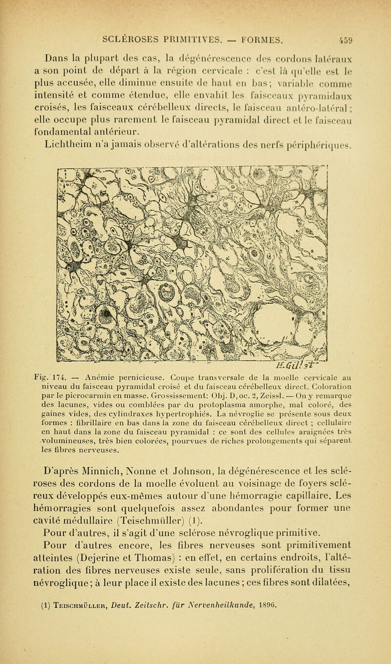 Dans la plupart des cas, la dég'énércsceiicc des cordons latéraux a son point de départ à la région cervicale : c'est là (prollc est le plus accusée, elle diminue ensuite de haut en bas; variable comme intensité et comme étendue, elle envahit les faisceaux pyramidaux croisés, les faisceaux cérébelleux directs, le faisceau antéro-latéral ; elle occupe plus rarement le faisceau pyramidal direct et le faisceau fondamental antérieur. Lichtheim n'a jamais observé d'altérations des nerfs périphériques. Fig. 174. — Anémie pernicieuse. Coupe transversale de la moelle cervicale au niveau du faisceau pyramidal croisé et du faisceau cérébelleux direct. Coloration par le picrocarmin en niasse. Grossissement: Obj. D, oc. 2, Zeissl. — On y remarque des lacunes, vides ou comblées par du protoplasma amorphe, mal coloré, des gaines vides, des cylindraxes hypertrophiés. La névroglie se présente sous deux formes : fibrillaire en bas dans la zone du faisceau cérébelleux direct ; cellulaire en haut dans la zone du faisceau pyramidal : ce sont des cellules araignées très •volumineuses, très bien colorées, pourvues de riches prolongements qui séparent les fibres nerveuses. D'après Minnich, Nonne et Johnson, la dégénérescence et les sclé- roses des cordons de la moelle évoluent au voisinage de foyers sclé- reux développés eux-mêmes autour d'une hémorragie capillaire. Les hémorragies sont quelquefois assez abondantes pour former une cavité médullaire (Teischmûller) (1). Pour d'autres, il s'agit d'une sclérose névroglique primitive. Pour d'autres encore, les fibres nerveuses sont primitivement atteintes (Dejerine et Thomas) : en effet, en certains endroits, l'alté- ration des fibres nerveuses existe seule, sans prolifération du tissu névroglique ; à leur place il existe des lacunes ; ces fibres sont dilatées, (1) TeischmOller, Deut. Zeitschr. fur Nervenheilkunde., 1896.