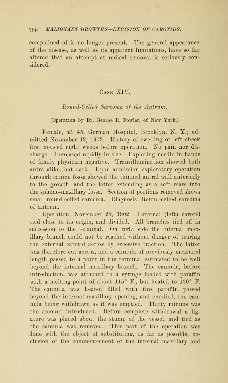 complained of is no longer present. The general appearance of the disease, as well as its apparent limitations, have so far altered that an attempt at radical removal is seriously con- sidered. Case XIV. Round-Celled Sarcoma of the Antrum. (Operation by Dr. George R. Fowler, of New York.) Female, at. 45, German Hospital, Brooklyn, N. Y.; ad- mitted November 12, 1902. History of swelling of left cheek first noticed eight weeks before operation. No pain nor dis- charge. Increased rapidly in size. Exploring needle in hands of family physician negative. Transillumination showed both antra alike, but dark. Upon admission exploratory operation through canine fossa showed the thinned antral wall anteriorly to the growth, and the latter extending as a soft mass into the spheno-maxillary fossa. Section of portions removed shows small round-celled sarcoma. Diagnosis: Round-celled sarcoma of antrum. Operation, November 24, 1902. External (left) carotid tied close to its origin, and divided. All branches tied off in succession to the terminal. On right side the internal max- illary branch could not be reached without danger of tearing the external carotid across by excessive traction. The latter was therefore cut across, and a cannula of previously measured length passed to a point in the terminal estimated to be well beyond the internal maxillary branch. The cannula, before introduction, was attached to a syringe loaded with paraffin with a melting-point of about 115° P., but heated to 120° F. The cannula was heated, filled with this paraffin, passed beyond the internal maxillary opening, and emptied, the can- nula being withdrawn as it was emptied. Thirty minims was the amount introduced. Before complete withdrawal a lig- ature was placed about the stump of the vessel, and tied as the cannula was removed. This part of the operation was done with the object of substituting, as far as possible, oc- clusion of the commencement of the internal maxillary and