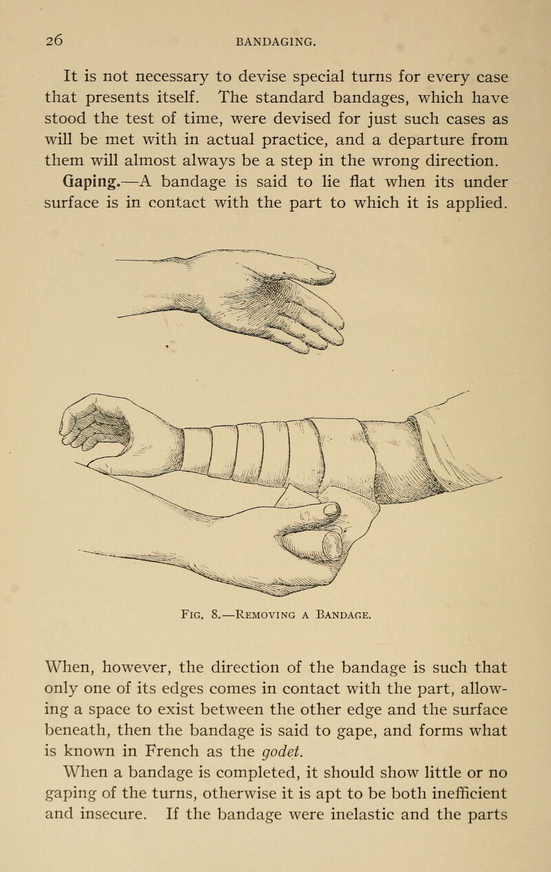 It is not necessary to devise special turns for every case that presents itself. The standard bandages, which have stood the test of time, were devised for just such cases as will be met with in actual practice, and a departure from them will almost always be a step in the wrong direction. Gaping.—A bandage is said to lie flat when its under surface is in contact with the part to which it is applied. Fig. 8.—Removing a Bandage. When, however, the direction of the bandage is such that only one of its edges comes in contact with the part, allow- ing a space to exist between the other edge and the surface beneath, then the bandage is said to gape, and forms what is known in French as the godet. When a bandage is completed, it should show little or no gaping of the turns, otherwise it is apt to be both inefficient and insecure. If the bandage were inelastic and the parts