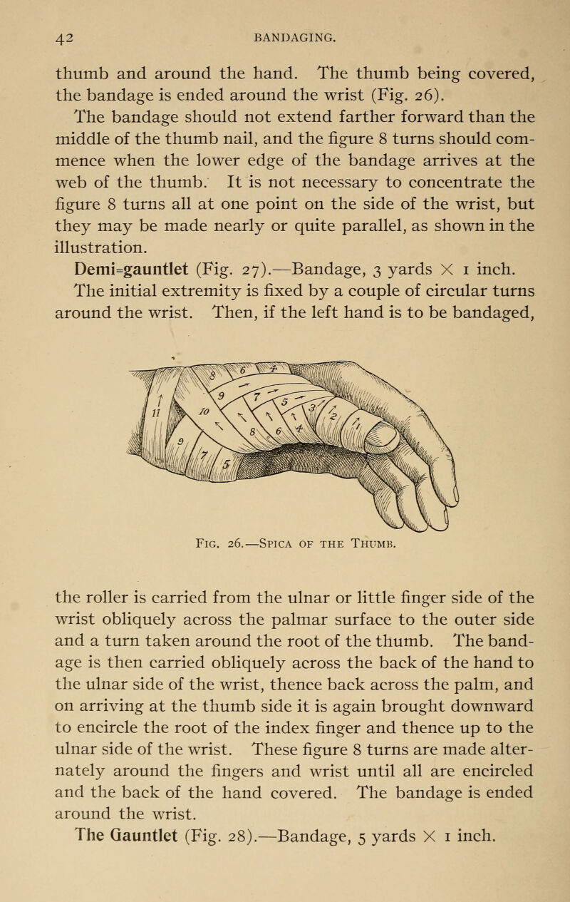 thumb and around the hand. The thumb being covered, the bandage is ended around the wrist (Fig. 26). The bandage should not extend farther forward than the middle of the thumb nail, and the figure 8 turns should com- mence when the lower edge of the bandage arrives at the web of the thumb. It is not necessary to concentrate the figure 8 turns all at one point on the side of the wrist, but they may be made nearly or quite parallel, as shown in the illustration. Demi=gauntlet (Fig. 27).—Bandage, 3 yards X i inch. The initial extremity is fixed by a couple of circular turns around the wrist. Then, if the left hand is to be bandaged, Fig. 26.—Spica of the Thumb. the roller is carried from the ulnar or little finger side of the wrist obliquely across the palmar surface to the outer side and a turn taken around the root of the thumb. The band- age is then carried obliquely across the back of the hand to the ulnar side of the wrist, thence back across the palm, and on arriving at the thumb side it is again brought downward to encircle the root of the index finger and thence up to the ulnar side of the wrist. These figure 8 turns are made alter- nately around the fingers and wrist until all are encircled and the back of the hand covered. The bandage is ended around the wrist. The Gauntlet (Fig. 28).—Bandage, 5 yards X i inch.