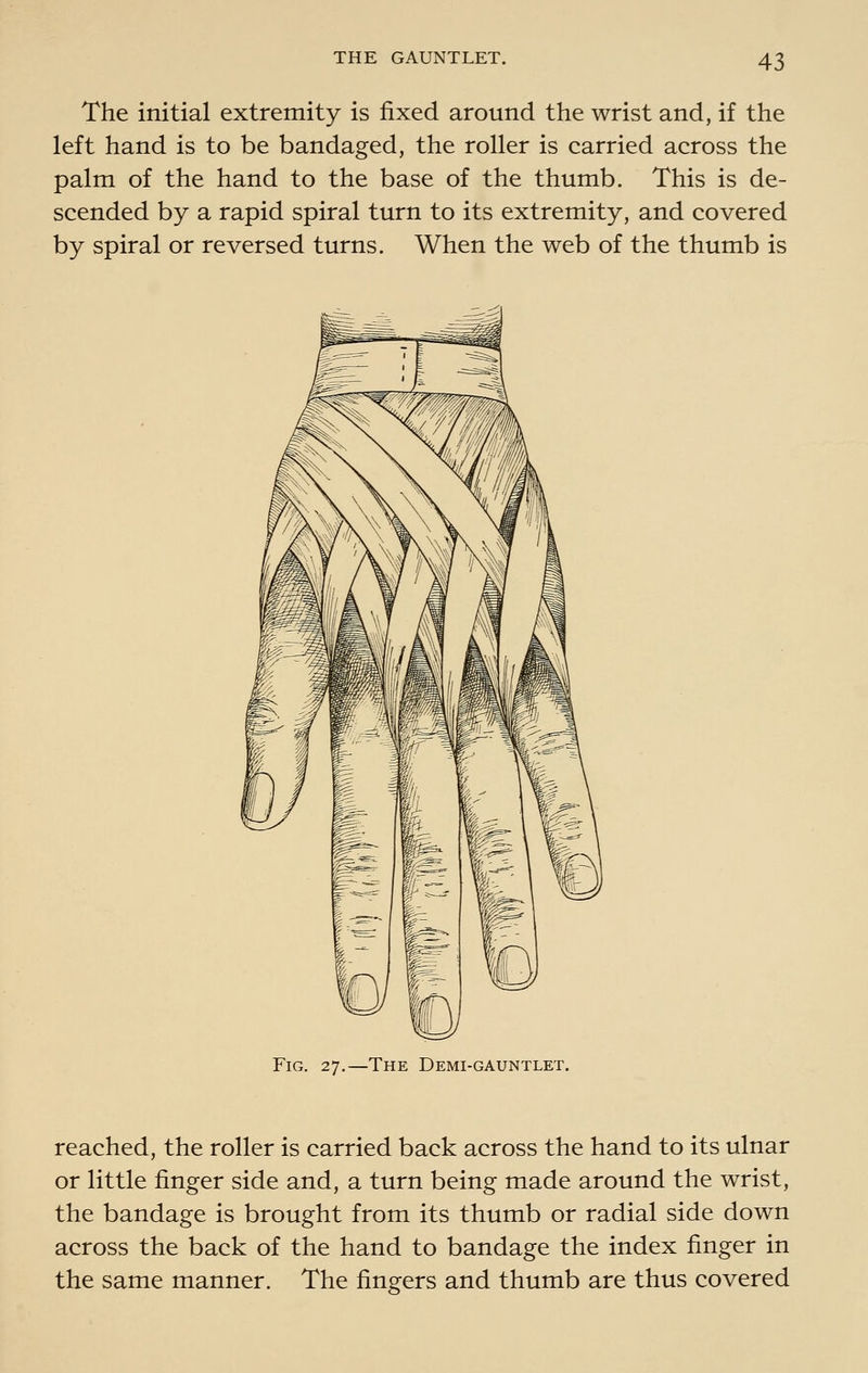 The initial extremity is fixed around the wrist and, if the left hand is to be bandaged, the roller is carried across the palm of the hand to the base of the thumb. This is de- scended by a rapid spiral turn to its extremity, and covered by spiral or reversed turns. When the web of the thumb is Fig. 27.—The Demi-gauntlet. reached, the roller is carried back across the hand to its ulnar or little finger side and, a turn being made around the wrist, the bandage is brought from its thumb or radial side down across the back of the hand to bandage the index finger in the same manner. The fingers and thumb are thus covered