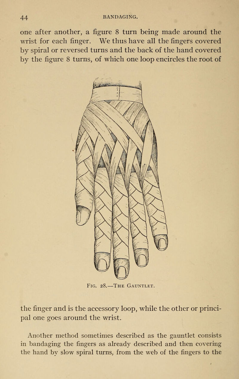 one after another, a figure 8 turn being made around the wrist for each finger. We thus have all the fingers covered by spiral or reversed turns and the back of the hand covered by the figure 8 turns, of which one loop encircles the root of Fig. 28.—The Gauntlet. the finger and is the accessory loop, while the other or princi- pal one goes around the wrist. Another method sometimes described as the gauntlet consists in bandaging the fingers as already described and then covering the hand by slow spiral turns, from the web of the fingers to the