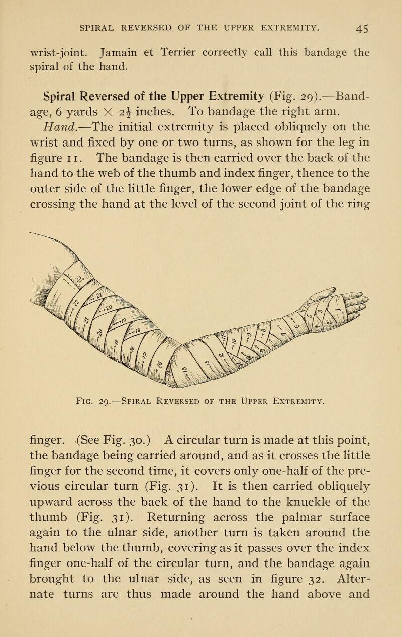 wrist-joint. Jamain et Terrier correctly call this bandage the spiral of the hand. Spiral Reversed of the Upper Extremity (Fig. 29).—Band- age, 6 yards X 2J inches. To bandage the right arm. Hand.—The initial extremity is placed obliquely on the wrist and fixed by one or two turns, as shown for the leg in figure 11. The bandage is then carried over the back of the hand to the web of the thumb and index finger, thence to the outer side of the little finger, the lower edge of the bandage crossing the hand at the level of the second joint of the ring Fig. 29.—Spiral Reversed of the Upper Extremity. finger. (See Fig. 30.) A circular turn is made at this point, the bandage being carried around, and as it crosses the little finger for the second time, it covers only one-half of the pre- vious circular turn (Fig. 31). It is then carried obliquely upward across the back of the hand to the knuckle of the thumb (Fig. 31). Returning across the palmar surface again to the ulnar side, another turn is taken around the hand below the thumb, covering as it passes over the index finger one-half of the circular turn, and the bandage again brought to the ulnar side, as seen in figure 32. Alter- nate turns are thus made around the hand above and