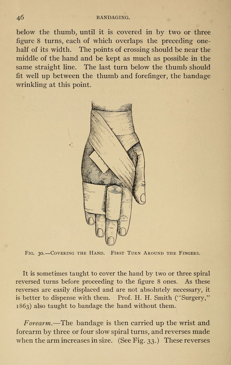 below the thumb, until it is covered in by two or three figure 8 turns, each of which overlaps the preceding one- half of its width. The points of crossing should be near the middle of the hand and be kept as much as possible in the same straight line. The last turn below the thumb should fit well up between the thumb and forefinger, the bandage wrinkling at this point. Fig. 30.—Covering the Hand. First Turn Around the Fingers. It is sometimes taught to cover the hand by two or three spiral reversed turns before proceeding to the figure 8 ones. As these reverses are easily displaced and are not absolutely necessary, it is better to dispense with them. Prof. H. H. Smith (Surgery, 1863) also taught to bandage the hand without them. Forearm.—The bandage is then carried up the wrist and forearm by three or four slow spiral turns, and reverses made when the arm increases in size. (See Fig. 33.) These reverses