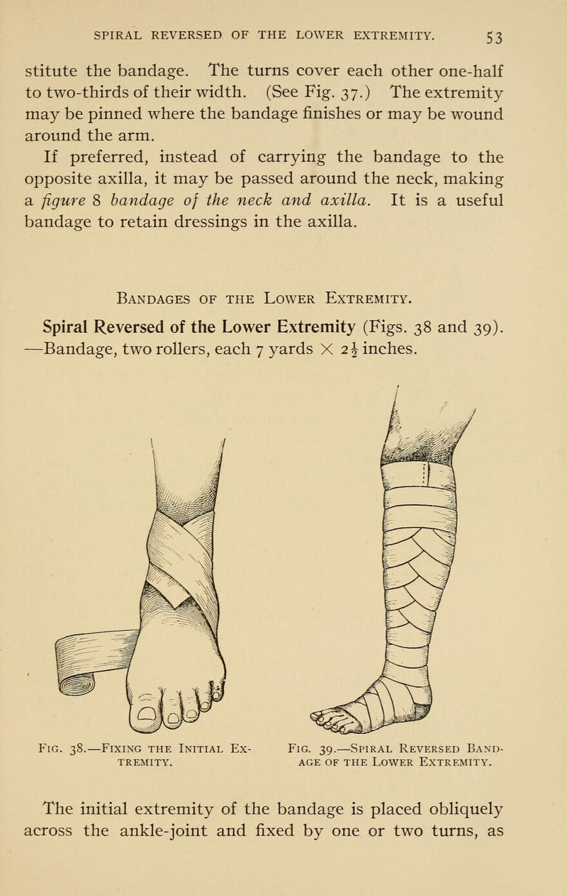 stitute the bandage. The turns cover each other one-half to two-thirds of their width. (See Fig. 37.) The extremity may be pinned where the bandage finishes or may be wound around the arm. If preferred, instead of carrying the bandage to the opposite axilla, it may be passed around the neck, making a figure 8 bandage of the neck and axilla. It is a useful bandage to retain dressings in the axilla. Bandages of the Lower Extremity. Spiral Reversed of the Lower Extremity (Figs. 38 and 39). -Bandage, two rollers, each 7 yards X 2 J inches. Fig, 38.—Fixing the Initial Ex- tremity. Fig. 39.—Spiral Reversed Band- age OF THE Lower Extremity. The initial extremity of the bandage is placed obliquely across the ankle-joint and fixed by one or two turns, as