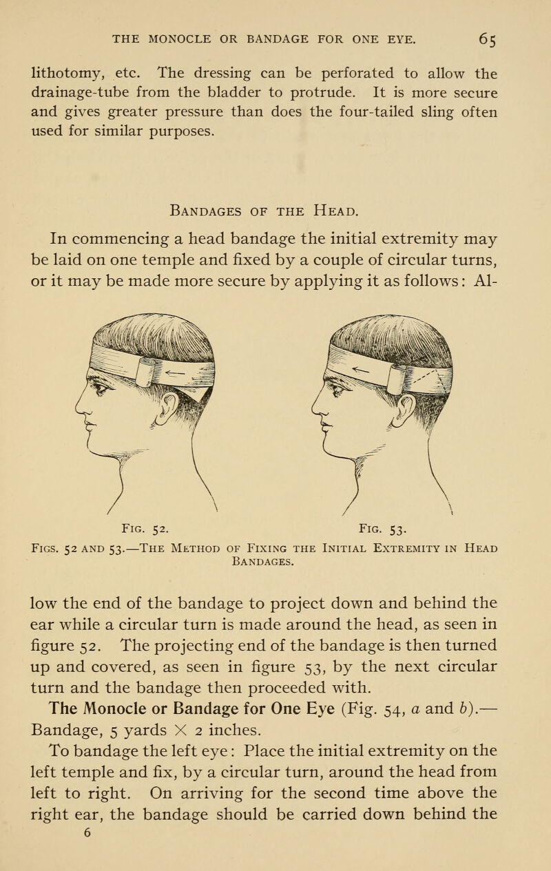 lithotomy, etc. The dressing can be perforated to allow the drainage-tube from the bladder to protrude. It is more secure and gives greater pressure than does the four-tailed sling often used for similar purposes. Bandages of the Head. In commencing a head bandage the initial extremity may be laid on one temple and fixed by a couple of circular turns, or it may be made more secure by applying it as follows: Al- FiG. 52. Fig. 53. Figs. 52 and 53.—The Method of FixiiNg the Initial Extremity in Head Bandages. low the end of the bandage to project down and behind the ear while a circular turn is made around the head, as seen in figure 52. The projecting end of the bandage is then turned up and covered, as seen in figure 53, by the next circular turn and the bandage then proceeded with. The Monocle or Bandage for One Eye (Fig. 54, a and b).— Bandage, 5 yards X 2 inches. To bandage the left eye: Place the initial extremity on the left temple and fix, by a circular turn, around the head from left to right. On arriving for the second time above the right ear, the bandage should be carried down behind the 6