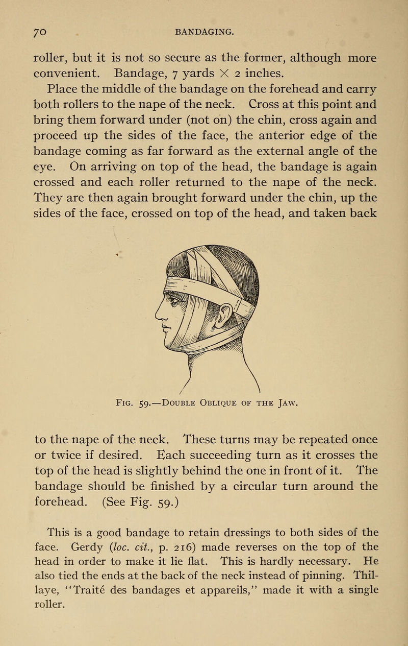 roller, but it is not so secure as the former, although more convenient. Bandage, 7 yards X 2 inches. Place the middle of the bandage on the forehead and carry both rollers to the nape of the neck. Cross at this point and bring them forward under (not on) the chin, cross again and proceed up the sides of the face, the anterior edge of the bandage coming as far forward as the external angle of the eye. On arriving on top of the head, the bandage is again crossed and each roller returned to the nape of the neck. They are then again brought forward under the chin, up the sides of the face, crossed on top of the head, and taken back Fig. 59.—Double Oblique of the Jaw. to the nape of the neck. These turns may be repeated once or twice if desired. Bach succeeding turn as it crosses the top of the head is slightly behind the one in front of it. The bandage should be finished by a circular turn around the forehead. (See Fig. 59.) This is a good bandage to retain dressings to both sides of the face. Gerdy {loc. cit, p. 216) made reverses on the top of the head in order to make it lie flat. This is hardly necessary. He also tied the ends at the back of the neck instead of pinning. Thil- laye, Traite des bandages et appareils, made it with a single roller.