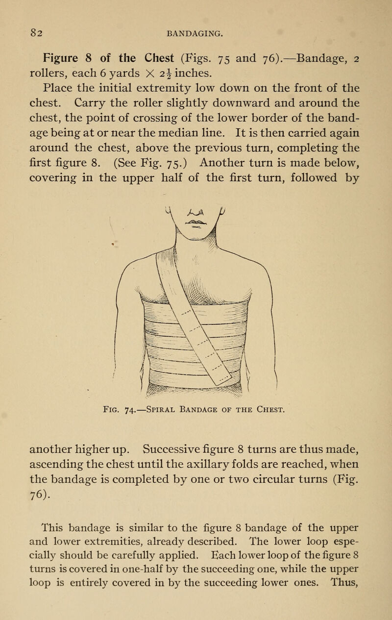 Figure 8 of the Chest (Figs. 75 and 76).—Bandage, 2 rollers, each 6 yards X 2^ inches. Place the initial extremity low down on the front of the chest. Carry the roller slightly downward and around the chest, the point of crossing of the lower border of the band- age being at or near the median line. It is then carried again around the chest, above the previous turn, completing the first figure 8. (See Fig. 75.) Another turn is made below, covering in the upper half of the first turn, followed by Fig. 74.—Spiral Bandage of the Chest. another higher up. Successive figure 8 turns are thus made, ascending the chest until the axillary folds are reached, when the bandage is completed by one or two circular turns (Fig. 76). This bandage is similar to the figure 8 bandage of the upper and lower extremities, already described. The lower loop espe- cially should be carefully applied. Each lower loop of the figure 8 turns is covered in one-half by the succeeding one, while the upper loop is entirely covered in by the succeeding lower ones. Thus,