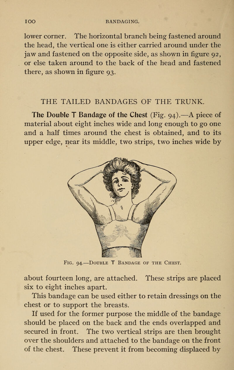 lower corner. The horizontal branch being fastened around the head, the vertical one is either carried around under the jaw and fastened on the opposite side, as shown in figure 92, or else taken around to the back of the head and fastened there, as shown in figure 93. THE TAILED BANDAGES OF THE TRUNK. The Double T Bandage of the Chest (Fig. 94).—A piece of material about eight inches wide and long enough to go one and a half times around the chest is obtained, and to its upper edge, near its middle, two strips, two inches wide by Fig. 94.—Double T Bandage of the Chest. about fourteen long, are attached. These strips are placed six to eight inches apart. This bandage can be used either to retain dressings on the chest or to support the breasts. If used for the former purpose the middle of the bandage should be placed on the back and the ends overlapped and secured in front. The two vertical strips are then brought over the shoulders and attached to the bandage on the front of the chest. These prevent it from becoming displaced by