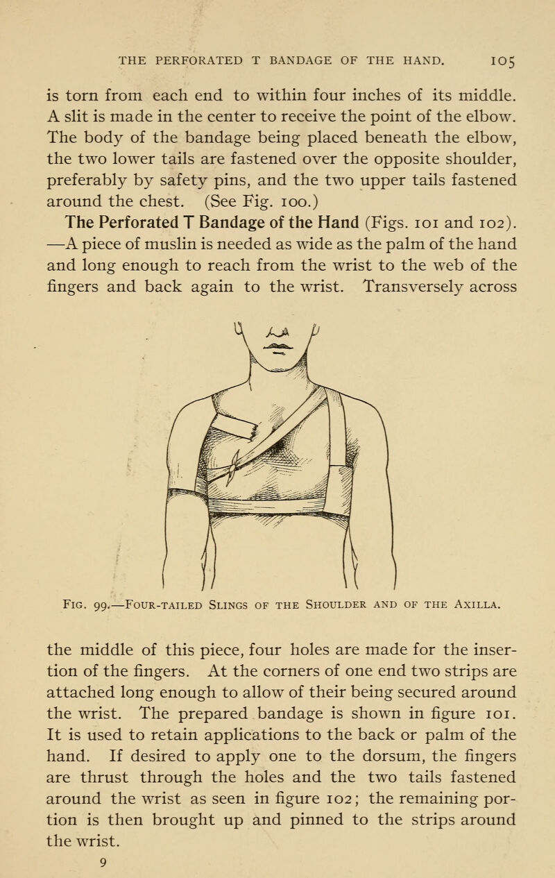 THE PERFORATED T BANDAGE OF THE HAND. IO5 is torn from each end to within four inches of its middle. A slit is made in the center to receive the point of the elbow. The body of the bandage being placed beneath the elbow, the two lower tails are fastened over the opposite shoulder, preferably by safety pins, and the two upper tails fastened around the chest. (See Fig. loo.) The Perforated T Bandage of the Hand (Figs. loi and 102). —A piece of muslin is needed as wide as the palm of the hand and long enough to reach from the wrist to the web of the fingers and back again to the wrist. Transversely across Fig. 99.—Four-tailed Slings of the Shoulder and of the Axilla, the middle of this piece, four holes are made for the inser- tion of the fingers. At the corners of one end two strips are attached long enough to allow of their being secured around the wrist. The prepared bandage is shown in figure loi. It is used to retain applications to the back or palm of the hand. If desired to apply one to the dorsum, the fingers are thrust through the holes and the two tails fastened around the wrist as seen in figure 102; the remaining por- tion is then brought up and pinned to the strips around the wrist. 9