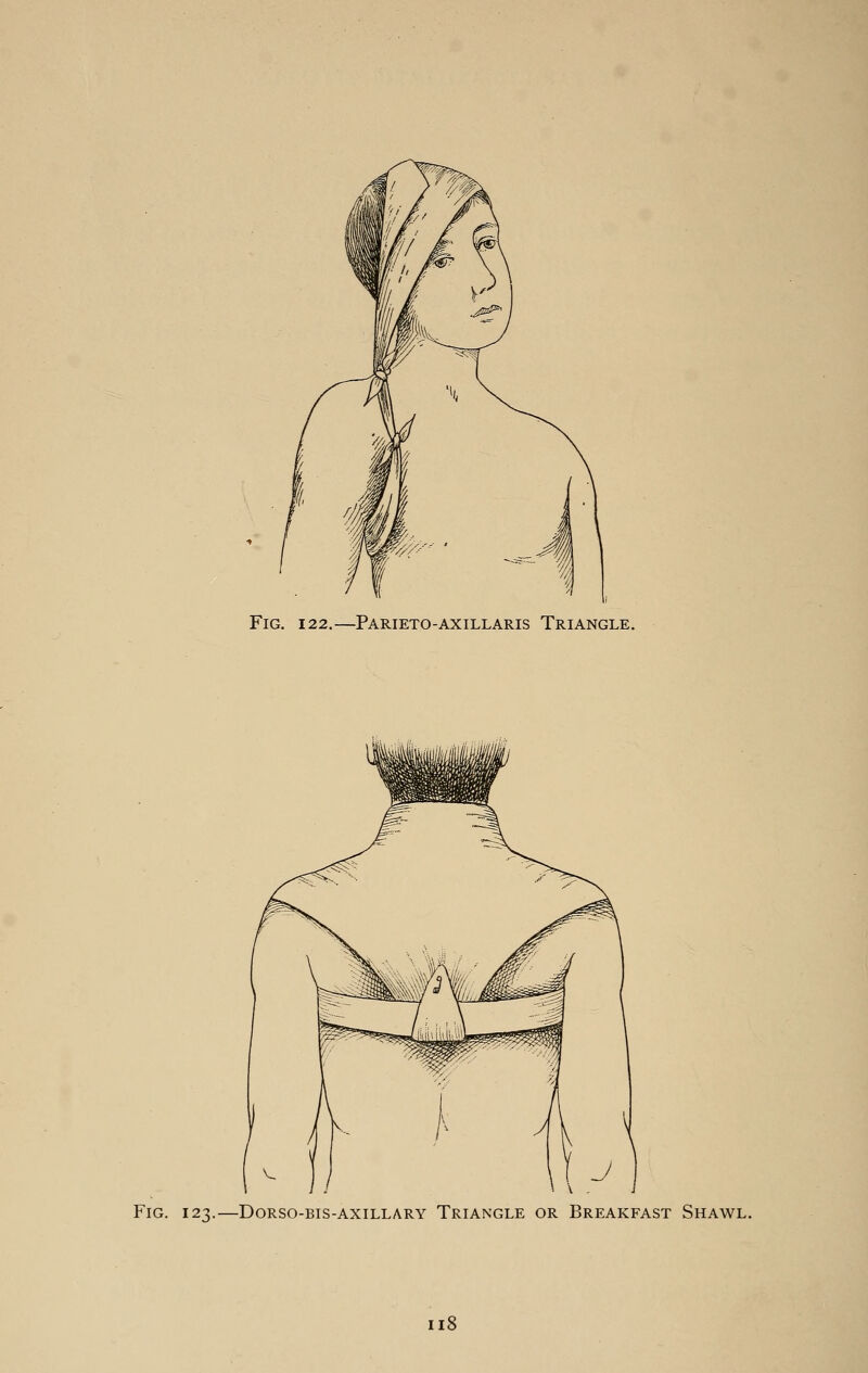 Fig. 122.—Parieto-axillaris Triangle Fig. 123.—DoRSo-Bis-AxiLLARY Triangle or Breakfast Shawl.