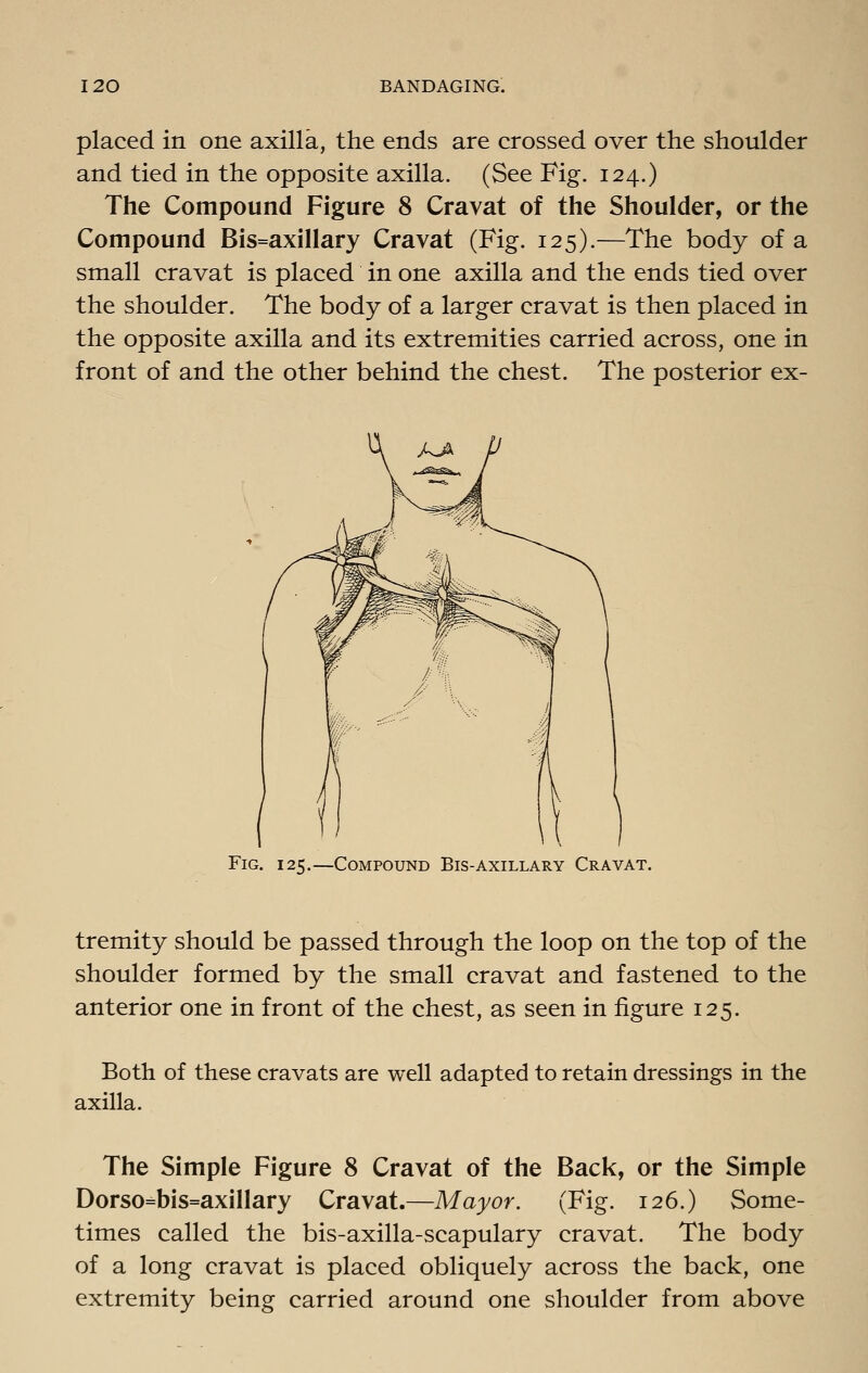placed in one axilla, the ends are crossed over the shoulder and tied in the opposite axilla. (See Fig. 124.) The Compound Figure 8 Cravat of the Shoulder, or the Compound Bis=axillary Cravat (Fig. 125).—The body of a small cravat is placed in one axilla and the ends tied over the shoulder. The body of a larger cravat is then placed in the opposite axilla and its extremities carried across, one in front of and the other behind the chest. The posterior ex- FiG. 121;,—Compound Bis-axillary Cravat. tremity should be passed through the loop on the top of the shoulder formed by the small cravat and fastened to the anterior one in front of the chest, as seen in figure 125. Both of these cravats are well adapted to retain dressings in the axilla. The Simple Figure 8 Cravat of the Back, or the Simple Dorso=bis=axillary Cravat.—Mayor. (Fig. 126.) Some- times called the bis-axilla-scapulary cravat. The body of a long cravat is placed obliquely across the back, one extremity being carried around one shoulder from above