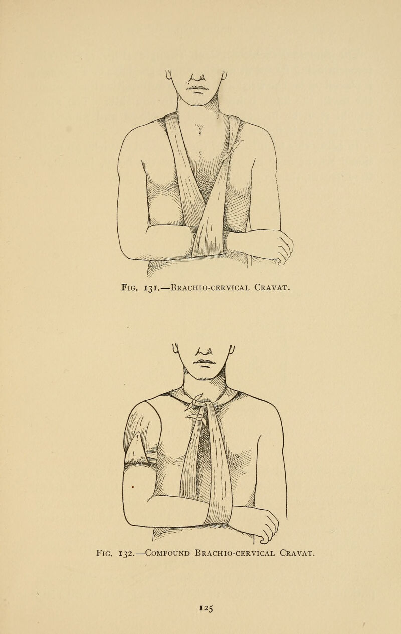Fig. 131.—Brachio-cervical Cravat. Fig. 132.—Compound Brachio-cervical Cravat.