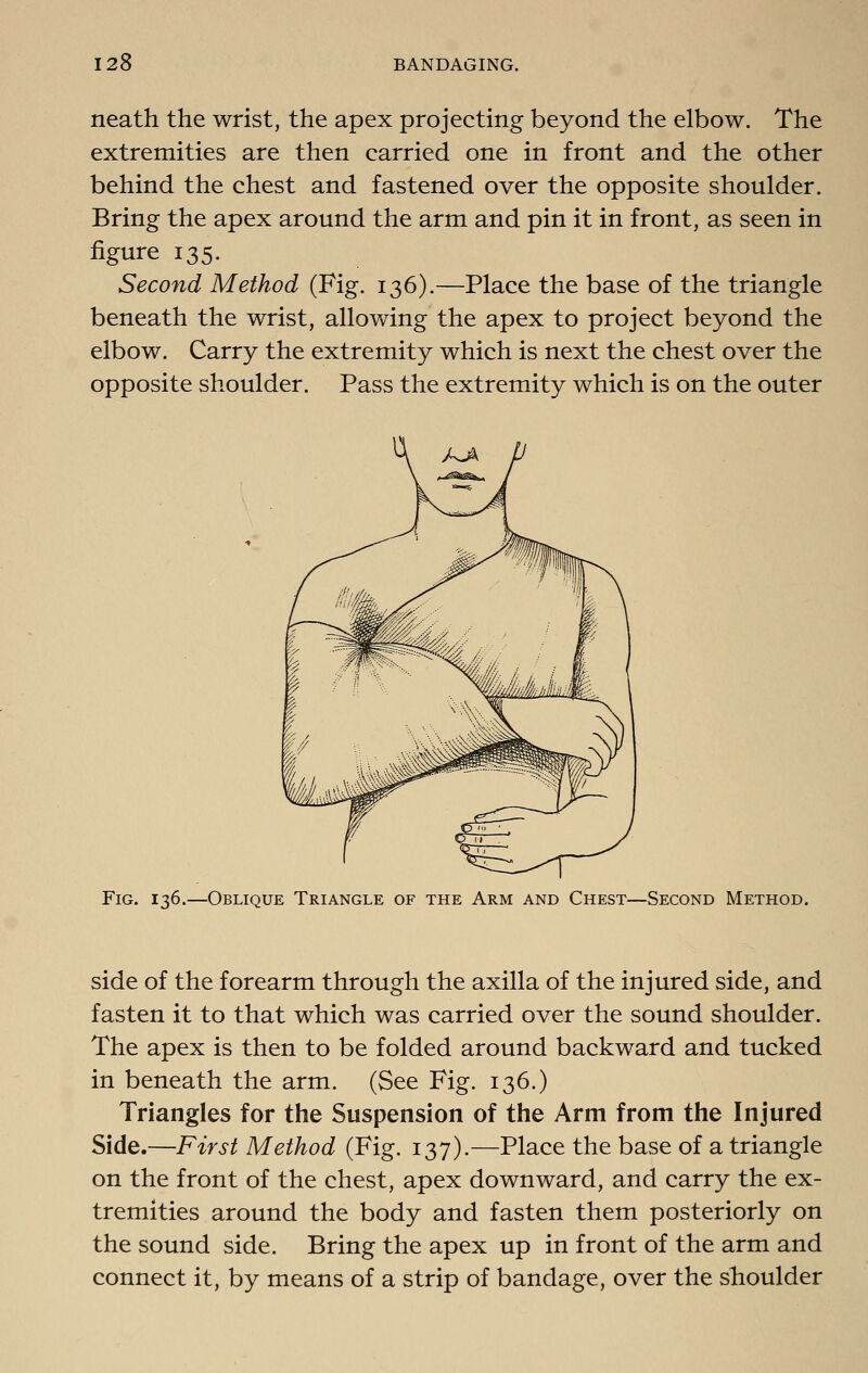 neath the wrist, the apex projecting beyond the elbow. The extremities are then carried one in front and the other behind the chest and fastened over the opposite shoulder. Bring the apex around the arm and pin it in front, as seen in figure 135. Second Method (Fig. 136).—Place the base of the triangle beneath the wrist, allov/ing the apex to project beyond the elbow. Carry the extremity which is next the chest over the opposite shoulder. Pass the extremity which is on the outer Fig. 136.—Oblique Triangle of the Arm and Chest—Second Method. side of the forearm through the axilla of the injured side, and fasten it to that which was carried over the sound shoulder. The apex is then to be folded around backward and tucked in beneath the arm. (See Fig. 136.) Triangles for the Suspension of the Arm from the Injured Side.—First Method (Fig. 137).—Place the base of a triangle on the front of the chest, apex downward, and carry the ex- tremities around the body and fasten them posteriorly on the sound side. Bring the apex up in front of the arm and connect it, by means of a strip of bandage, over the shoulder