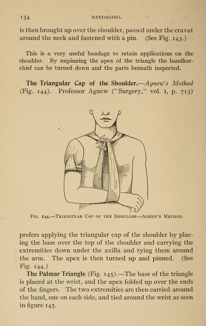 is then brought up over the shoulder, passed under the cravat around the neck and fastened with a pin. (See Fig. 143.) This is a very useful bandage to retain applications on the shoulder. By unpinning the apex of the triangle the handker- chief can be turned down and the parts beneath inspected. The Triangular Cap of the Shoulder.—Agnew's Method (Fig. 144). Professor Agnew (Surgery, vol. i, p. 713) Fig. 144.—Triangular Cap of the Shoulder—Agnew's Method. prefers applying the triangular cap of the shoulder by plac- ing the base over the top of the shoulder and carrying the extremities down under the axilla and tying them around the arm. The apex is then turned up and pinned. (See Fig. 144.) The Palmar Triangle (Fig. 145).—The base of the triangle is placed at the wrist, and the apex folded up over the ends of the fingers. The two extremities are then carried around the hand, one on each side, and tied around the wrist as seen in figure 145.
