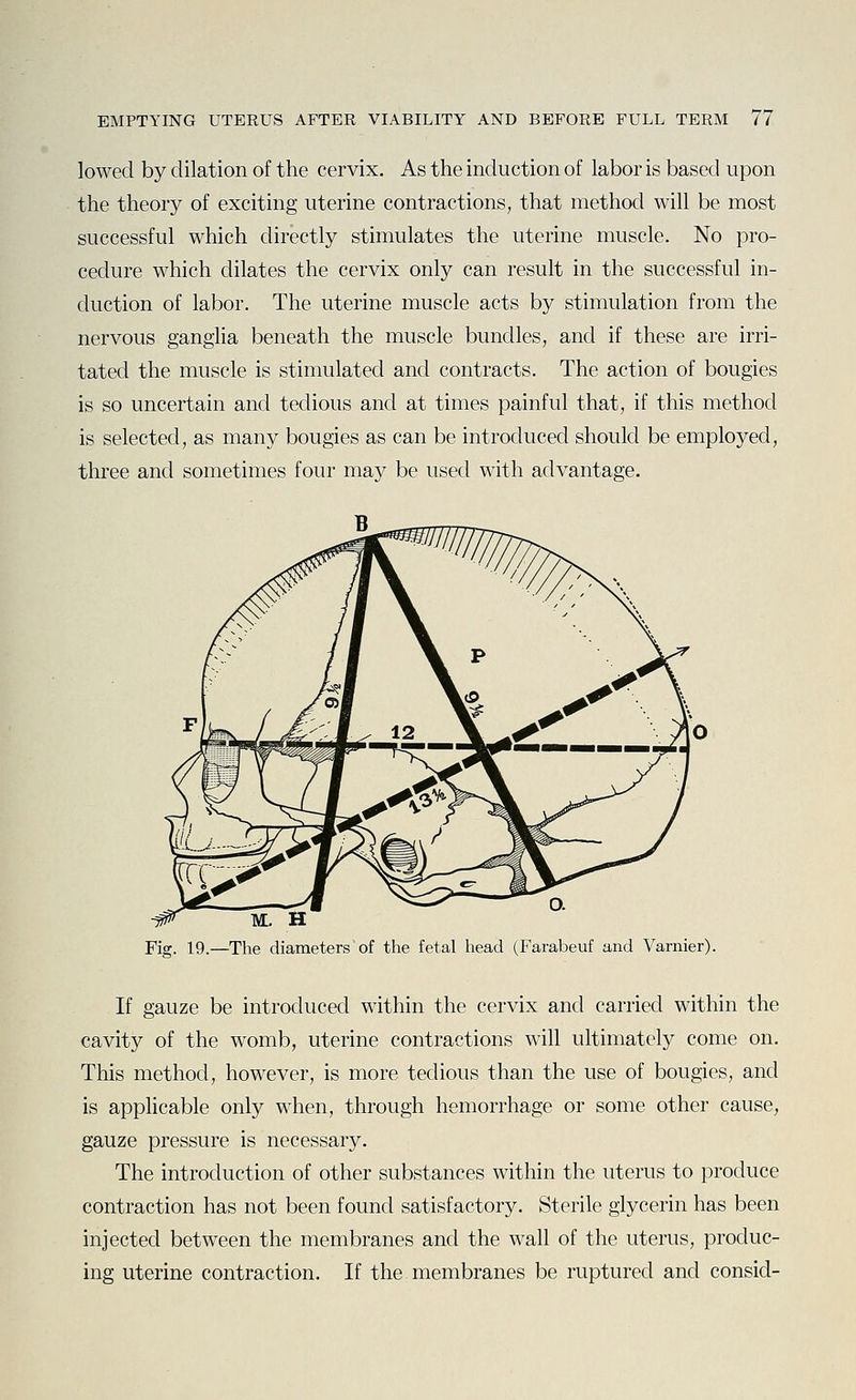 lowed by dilation of the cervix. As the induction of labor is based upon the theory of exciting uterine contractions, that method will be most successful which directly stimulates the uterine muscle. No pro- cedure which dilates the cervix only can result in the successful in- duction of labor. The uterine muscle acts by stimulation from the nervous gangha beneath the muscle bundles, and if these are irri- tated the muscle is stimulated and contracts. The action of bougies is so uncertain and tedious and at times painful that, if this method is selected, as many bougies as can be introduced should be employed, three and sometimes four may be used with advantage. W TVL H Fig. 19.—The diameters of the fetal liead (Farabeuf and Varnier). If gauze be introduced within the cervix and carried within the cavity of the womb, uterine contractions will ultimately come on. This method, however, is more tedious than the use of bougies, and is applicable only when, through hemorrhage or some other cause, gauze pressure is necessary. The introduction of other substances within the uterus to produce contraction has not been found satisfactory. Sterile glycerin has been injected between the membranes and the wall of the uterus, produc- ing uterine contraction. If the membranes be ruptured and consid-