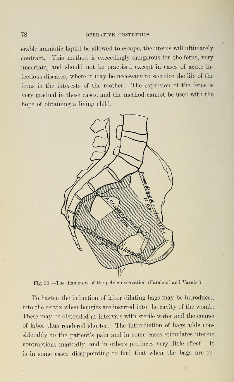 erable amniotic liquid be allowed to escape, the uterus will ultimately contract. This method is exceedingly dangerous for the fetus, very uncertain, and should not be practised except in cases of acute in- fectious diseases, where it may be necessary to sacrifice the Hfe of the fetus in the interests of the mother. The expulsion of the fetus is very gradual in these cases, and the method cannot be used with the hope of obtaining a living child. Fig. 20.—The diameters of the pelvic excavation (Farabeuf and Varnier). To hasten the induction of labor dilating bags may be introduced into the cervix when bougies are inserted into the cavity of the womb. These may be distended at intervals with sterile water and the course of labor thus rendered shorter. The introduction of bags adds con- siderably to the patient's pain and in some cases stimulates uterine contractions markedly, and in others produces very little effect. It is in some cases disappointing to find that when the bags are re-