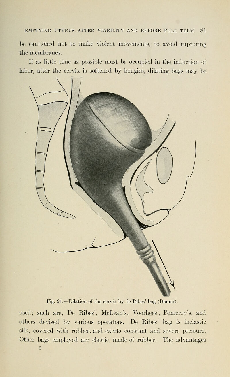 be cautioned not to make violent movements, to avoid rupturing the membranes. If as little time as possible must be occupied in the induction of labor, after the cervix is softened by bougies, dilating bags may be Fig. 21.—Dilation of the cervix by de Ribes' bag (Bumm). used; such are, De Ribes', McLean's, Voorhees', Pomeroy's, and others devised by various operators. De Ribes' bag is inelastic silk, covered with rubber, and exerts constant and severe pressure. Other bags employed are elastic, made of rubber. The advantages 6