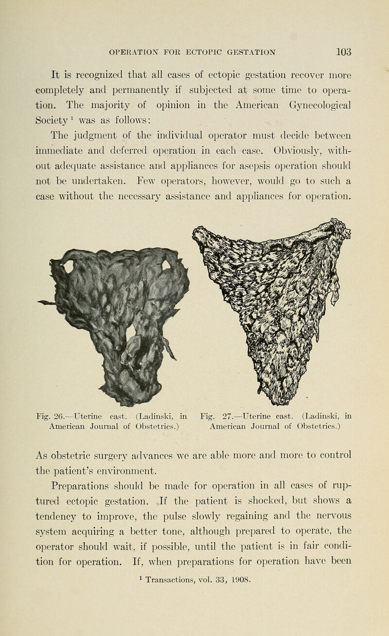 It is recognized that all cases of ectopic gestation recover more completely and permanently if subjected at some time to opera- tion. The majority of opinion in the American Gynecological Society ^ was as follows: The judgment of the individual operator must decide between immediate and deferred operation in each case. Obviously, with- out adequate assistance and appliances for asepsis operation should not be undertaken. Few operators, however, would go to such a case without the necessary assistance and appliances for operation. Fig. 26.—Uterine cast. (Ladinski, in American Journal of Obstetrics.) Fig. 27.—Uterine cast. (Ladinski, in American Journal of Obstetrics.) As obstetric surgery advances we are able more and more to control the patient's environment. Preparations should be made for operation in all cases of rup- tured ectopic gestation. If the patient is shocked, but shows a tendency to improve, the pulse slowly regaining and the nervous system acquiring a better tone, although prepared to operate, the operator should wait, if possible, until the patient is in fair condi- tion for operation. If, when preparations for operation have been 1 Transactions, vol. 33, 1908.