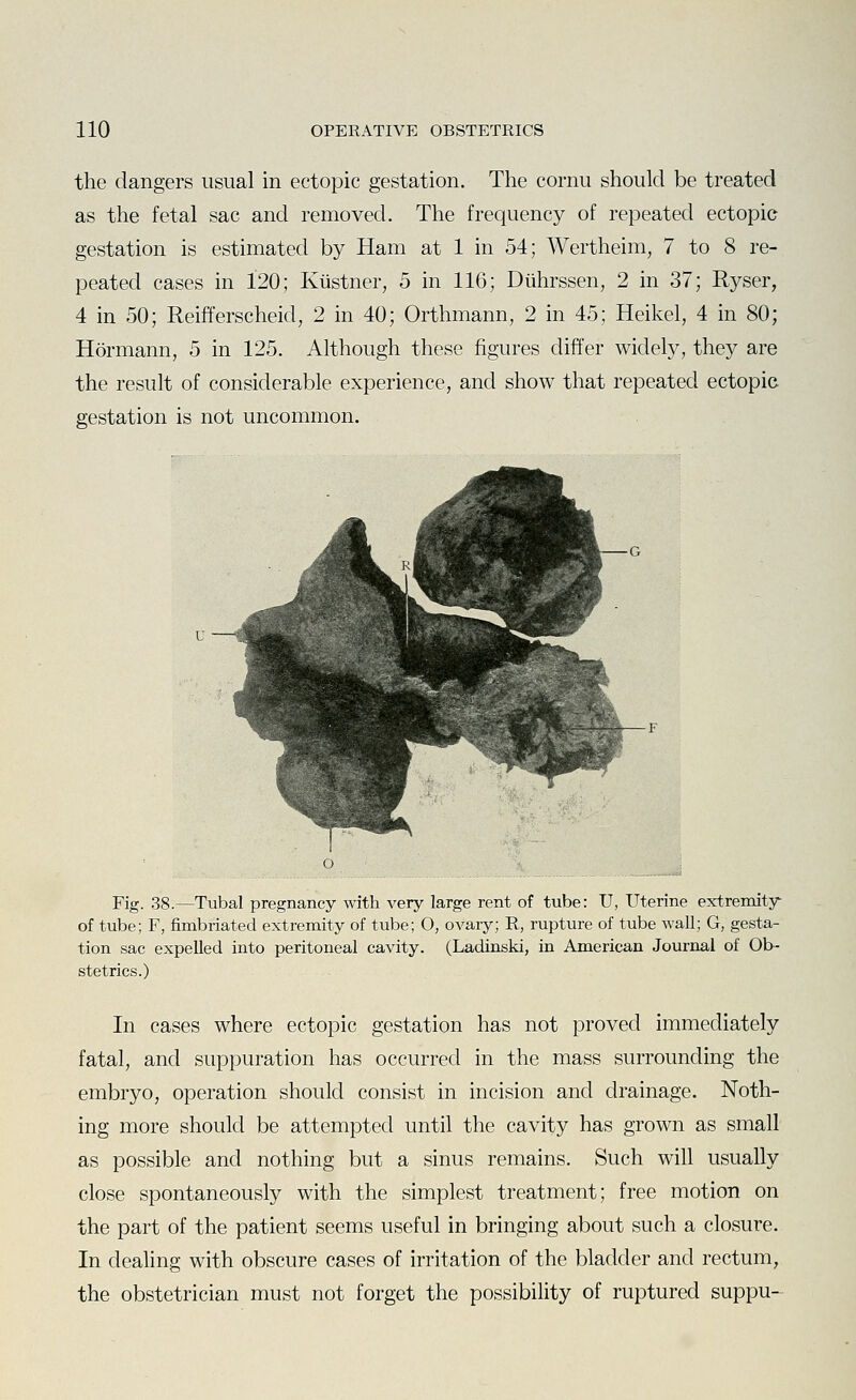 the dangers usual in ectopic gestation. The cornu should be treated as the fetal sac and removed. The frequency of repeated ectopic gestation is estimated by Ham at 1 in 54; Wertheim, 7 to 8 re- peated cases in 120; Kiistner, 5 in 116; Diihrssen, 2 in 37; Ryser, 4 in 50; Reifferscheid, 2 in 40; Orthmann, 2 in 45; Heikel, 4 in 80; Hermann, 5 in 125. Although these figures differ widely, they are the result of considerable experience, and show that repeated ectopia gestation is not uncommon. Fig. 38.—Tubal pregnancy with very large rent of tube: U, Uterine extremity' of tube; F, fimbriated extremity of tube; O, ovary; R, rupture of tube wall; G, gesta- tion sac expelled into peritoneal cavity. (Ladinski, in American Journal of Ob- stetrics.) In cases where ectopic gestation has not proved immediately fatal, and suppuration has occurred in the mass surrounding the embryo, operation should consist in incision and drainage. Noth- ing more should be attempted until the cavity has grown as small as possible and nothing but a sinus remains. Such will usually close spontaneously with the simplest treatment; free motion on the part of the patient seems useful in bringing about such a closure. In dealing with obscure cases of irritation of the bladder and rectum, the obstetrician must not forget the possibility of ruptured suppu--
