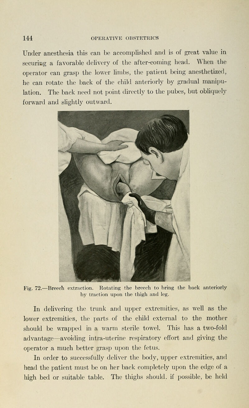 Under anesthesia this can be accomplished and is of great value in securing a favorable delivery of the after-coming head. When the operator can grasp the lower limbs, the patient being anesthetized, he can rotate the back of the child anteriorly by gradual manipu- lation. The back need not point directly to the pubes, but obHquely forward and slightly outward. Fig. 72.—Breech extraction. Rotating the breech to bring the back anteriorly by traction upon the thigh and leg. In delivering the trunk and upper extremities, as well as the lower extremities, the parts of the child external to the mother should be wrapped in a warm sterile towel. This has a two-fold advantage—avoiding intra-uterine respiratory effort and giving the operator a much better grasp upon the fetus. In order to successfully deliver the body, upper extremities, and head the patient must be on her back completely upon the edge of a high bed or suitable table. The thighs should, if possible, be held