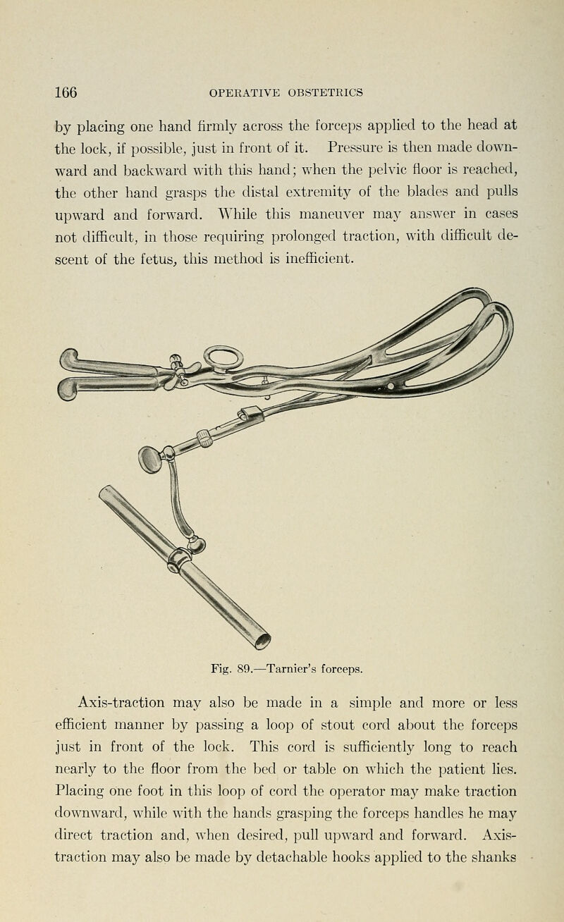 by placing one hand firmly across the forceps applied to the head at the lock, if possible, just in front of it. Pressure is then made down- ward and backward with this hand; when the pelvic floor is reached, the other hand grasps the distal extremity of the blades and pulls upward and forward. While this maneuver may answer in cases not difficult, in those requiring prolonged traction, with difficult de- scent of the fetus, this method is inefficient. Fig. 89.—Tarnier's forceps. Axis-traction may also be made in a simple and more or less efficient manner by passing a loop of stout cord about the forceps just in front of the lock. This cord is sufficiently long to reach nearly to the floor from the bed or table on which the patient lies. Placing one foot in this loop of cord the operator may make traction downward, while with the hands grasping the forceps handles he may direct traction and, when desired, pull upward and forward. Axis- traction may also be made by detachable hooks applied to the shanks