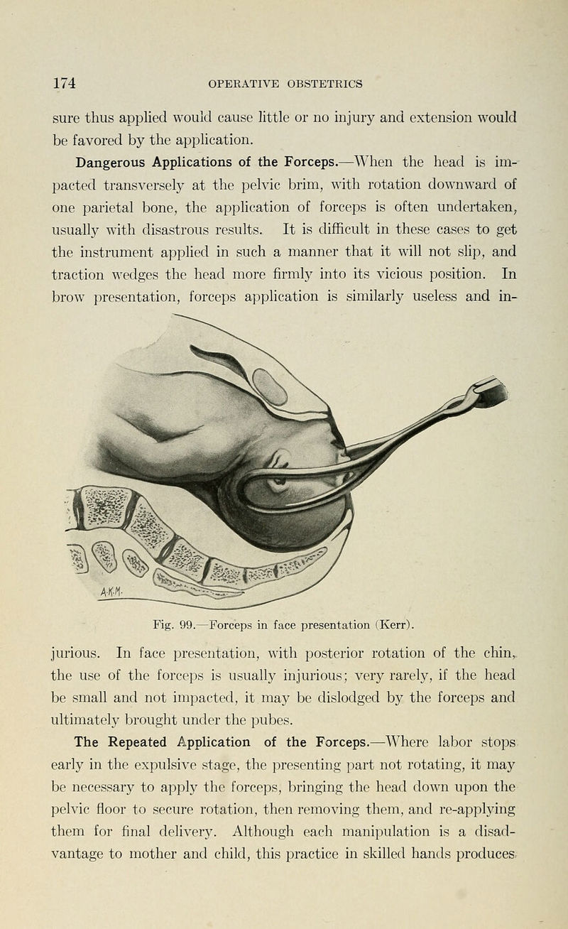 sure thus applied would cause little or no injury and extension would be favored by the application. Dangerous Applications of the Forceps.^When the head is im- pacted transversely at the pelvic brim, with rotation downward of one parietal bone, the apphcation of forceps is often undertaken^ usually with disastrous results. It is difficult in these cases to get the instrument applied in such a manner that it will not slip, and traction wedges the head more firmly into its vicious position. In brow presentation, forceps application is similarly useless and in- Fig. 99.—Forceps in face presentation (Kerr). jurious. In face presentation, with posterior rotation of the chin, the use of the forceps is usually injurious; very rarely, if the head be small and not impacted, it may be dislodged by the forceps and ultimately brought under the pubes. The Repeated Application of the Forceps.—^Where labor stops early in the expulsive stage, the presenting part not rotating, it may be necessary to apply the forceps, bringing the head down upon the pelvic floor to secure rotation, then removing them, and re-applying them for final delivery. Although each manipulation is a disad- vantage to mother and child, this practice in skilled hands produces.
