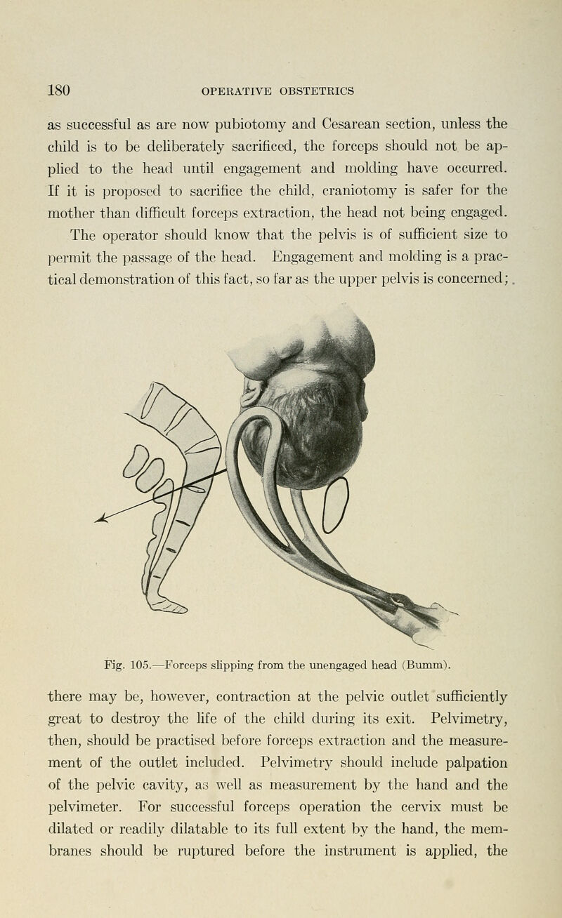 as successful as are now pubiotomy and Cesarean section, unless the child is to be deliberately sacrificed, the forceps should not be ap- plied to the head until engagement and molding have occurred. If it is proposed to sacrifice the child, craniotomy is safer for the mother than difficult forceps extraction, the head not being engaged. The operator should know that the pelvis is of sufficient size to permit the passage of the head. Engagement and molding is a prac- tical demonstration of this fact, so far as the upper pelvis is concerned; Fig. 105.—Forceps slipping from the unengaged head (Bumm). there may be, however, contraction at the pelvic outlet sufficiently great to destroy the life of the child during its exit. Pelvimetry, then, should be practised before forceps extraction and the measure- ment of the outlet included. Pelvimetry should include palpation of the pelvic cavity, as well as measurement by the hand and the pelvimeter. For successful forceps operation the cervix must be dilated or readily dilatable to its full extent by the hand, the mem- branes should be ruptured before the instrument is applied, the
