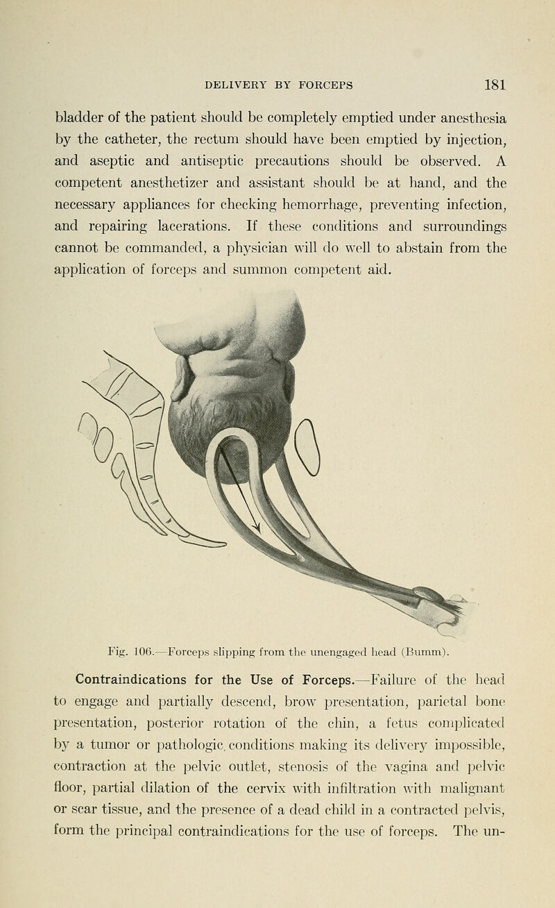 bladder of the patient should be completely emptied under anesthesia by the catheter, the rectum should have been emptied by injection, and aseptic and antiseptic precautions should be observed. A competent anesthetizer and assistant should be at hand, and the necessary appliances for checking hemorrhage, preventing infection, and repairing lacerations. If these conditions and surroundings cannot be commanded, a physician will do well to abstain from the application of forceps and summon competent aid. Fig. 106.—Forceps slipping from the unengaged head (Bumm). Contraindications for the Use of Forceps.—Failure of the head to engage and partially descend, brow presentation, parietal bone presentation, posterior rotation of the chin, a fetus complicated by a tumor or pathologic, conditions making its delivery impossible, contraction at the pelvic outlet, stenosis of the vagina and pelvic floor, partial dilation of the cervix with infiltration with malignant or scar tissue, and the presence of a dead child in a contracted pelvis, form the principal contraindications for the use of forceps. The un-