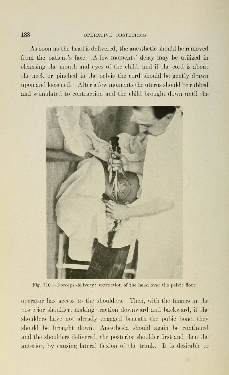 As soon as the head is deUvered, the anesthetic should be removed from the patient's face. A few moments' delay may be utilized in cleansing the mouth and eyes of the child, and if the cord is about the, neck or pinched in the pelvis the cord should be gently drawn upon and loosened. After a few moments the uterus should be rubbed and stimulated to contraction and the child brought down until the Fig. 110.—Forceps delivery: extraction of the head over the pelvic floor. operator has access to the shoulders. Then, with the fingers in the posterior shoulder, making traction downward and backward, if the shoulders have not already engaged beneath the pubic bone, they should be brought down. Anesthesia should again be continued and the shoulders dehvered, the posterior shoulder first and then the anterior, by causing lateral flexion of the trunk. It is desirable to