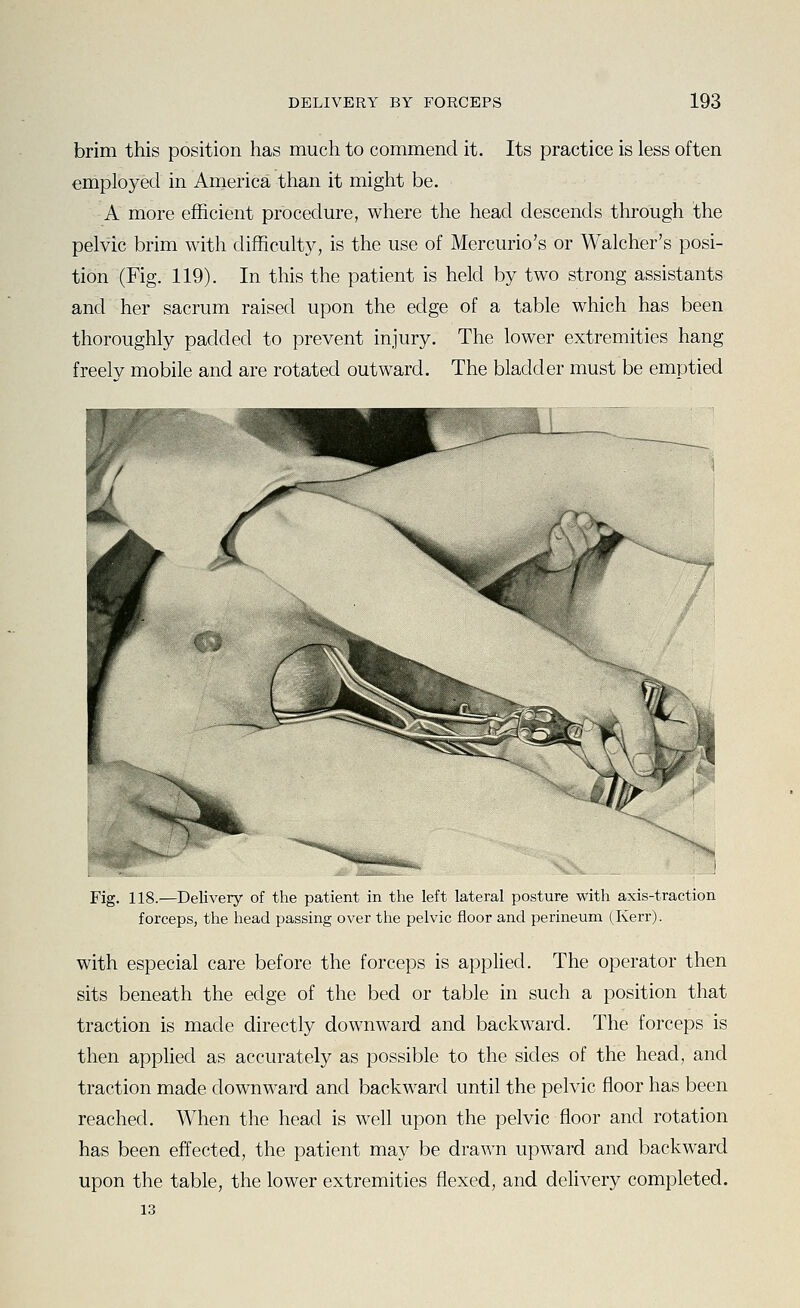 brim this position has much to commend it. Its practice is less often employed in America than it might be. A more efficient procedure, where the head descends through the pelvic brim with difficulty, is the use of Mercurio's or Walcher's posi- tion (Fig. 119). In this the patient is held by two strong assistants and her sacrum raised upon the edge of a table which has been thoroughly padded to prevent injury. The lower extremities hang freelv mobile and are rotated outward. The bladder must be emptied Fig. 118.—Delivery of the patient in tlie left lateral posture with axis-traction forceps, the head passing over the pelvic floor and perineum (Kerr). with especial care before the forceps is applied. The operator then sits beneath the edge of the bed or table in such a position that traction is made directly downward and backward. The forceps is then applied as accurately as possible to the sides of the head, and traction made downward and backward until the pelvic floor has been reached. When the head is well upon the pelvic floor and rotation has been effected, the patient may be drawn upward and backward upon the table, the lower extremities flexed, and delivery completed. 13