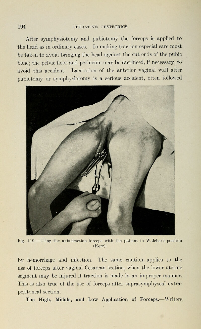 After symphysiotomy and pubiotomy the forceps is apphed to the head as in ordinary cases. In making traction especial care must be taken to avoid bringing the head against the cut ends of the pubic bone; the pelvic floor and perineum may be sacrificed, if necessary, to avoid this accident. Laceration of the anterior vaginal wall after pubiotomy or symphysiotomy is a serious accident, often followed Fig. 119.—Using the axis-traction forceps with the patient in Walcher's position (Kerr). by hemorrhage and infection. The same caution applies to the use of forceps after vaginal Cesarean section, when the lower uterine segment may be injured if traction is made in an improper manner. This is also true of the use of forceps after suprasymphyseal extra- peritoneal section. The High, Middle, and Low Application of Forceps.—Writers