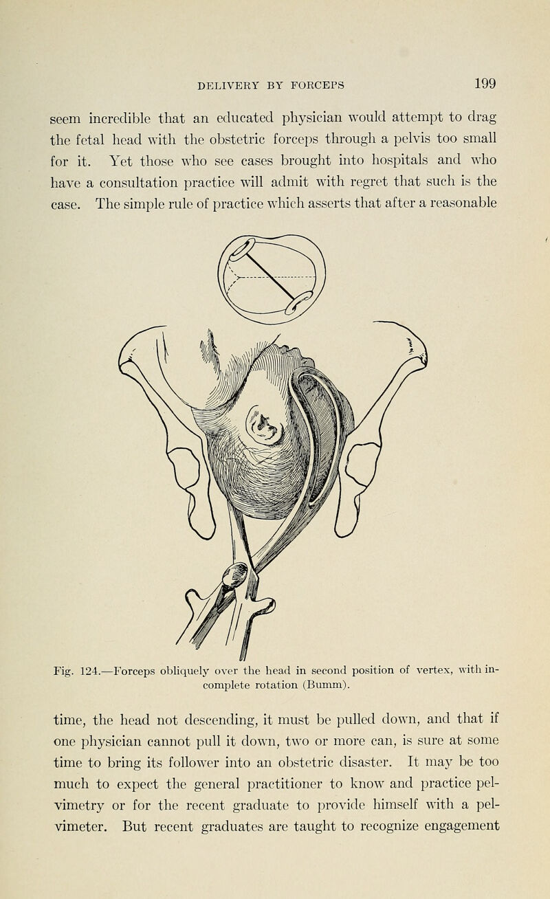 seem incredible that an educated physician would attempt to drag the fetal head with the obstetric forceps through a pelvis too small for it. Yet those who see cases brought into hospitals and who have a consultation practice will admit with regret that such is the case. The simple rule of practice which asserts that after a reasonable Fig. 124.—Forceps obliquely over the head in second position of vertex, with in- complete rotation (Bumm). time, the head not descending, it must be pulled down, and that if one physician cannot pull it down, two or more can, is sure at some time to bring its follower into an obstetric disaster. It may be too much to expect the general practitioner to know and practice pel- vimetry or for the recent graduate to provide himself with a pel- vimeter. But recent graduates are taught to recognize engagement