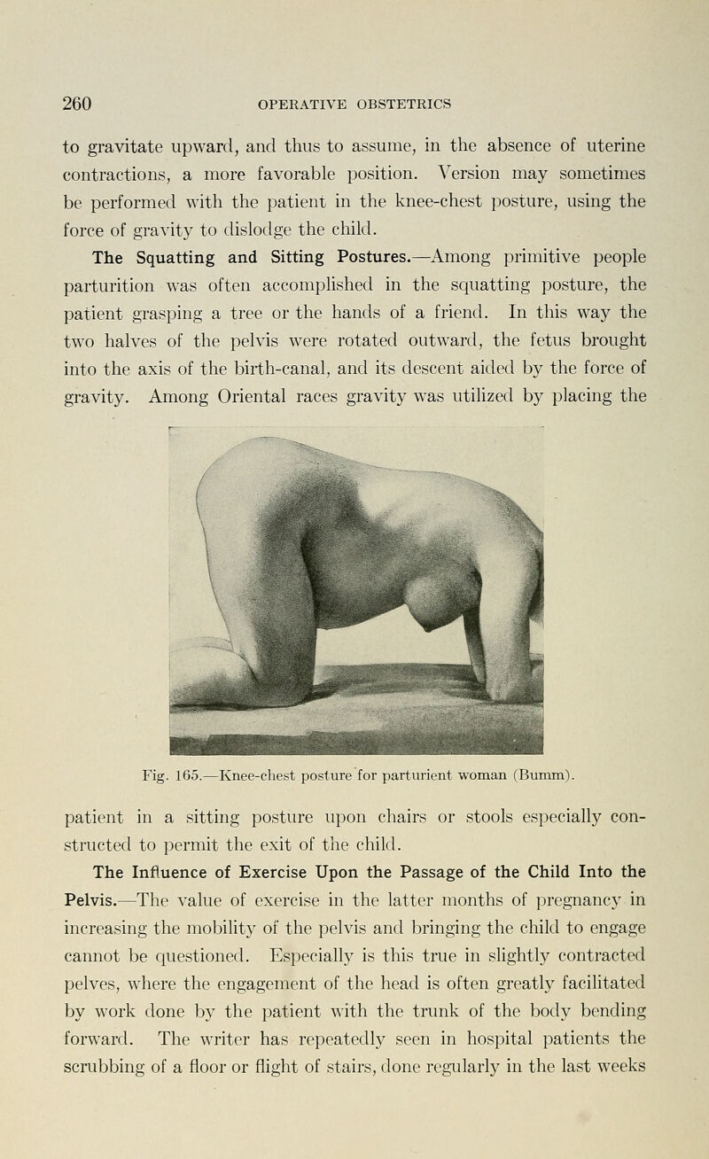 to gravitate upward, and thus to assume, in the absence of uterine contractions, a more favorable position. Version may sometimes be performed with the patient in the knee-chest posture, using the force of gravity to dislodge the child. The Squatting and Sitting Postures.—Among primitive people parturition was often accomplished in the squatting posture, the patient grasping a tree or the hands of a friend. In this way the two halves of the pelvis were rotated outward, the fetus brought into the axis of the birth-canal, and its descent aided by the force of gravity. Among Oriental races gravity was utilized by placing the Fig. 165.—Knee-chest posture for parturient woman (Bumm). patient in a sitting posture upon chairs or stools especially con- structed to permit the exit of the child. The Influence of Exercise Upon the Passage of the Child Into the Pelvis.—The value of exercise in the latter months of pregnancy in increasing the mobility of the pelvis and bringing the child to engage cannot be questioned. Especially is this true in slightly contracted pelves, where the engagement of the head is often greatly facilitated by work done by the patient with the trunk of the body bending forward. The writer has repeatedly seen in hospital patients the scrubbing of a floor or flight of stairs, done regularly in the last weeks