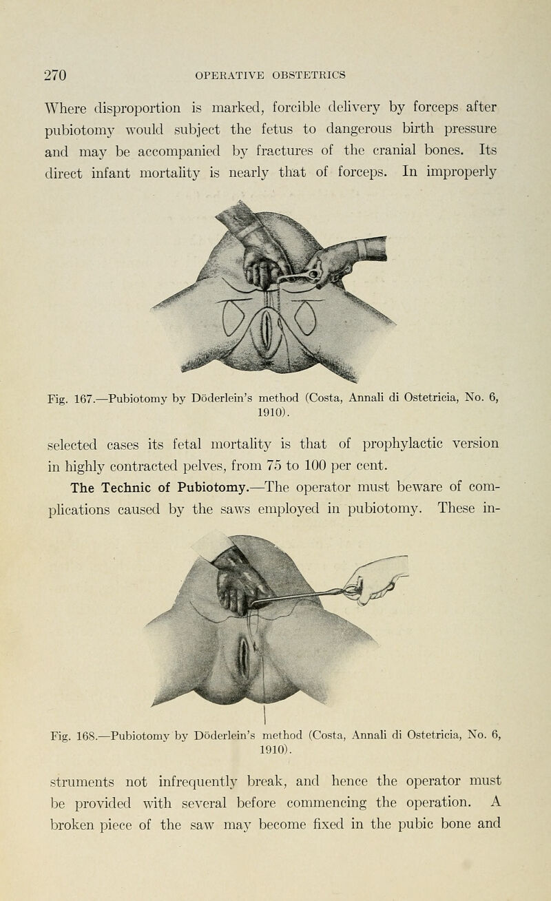 Where disproportion is marked, forcible delivery by forceps after pubiotomy would subject the fetus to dangerous birth pressure and may be accompanied by fractures of the cranial bones. Its direct infant mortality is nearly that of forceps. In improperly Fig. 167.—Pubiotomy by Doderlein's method (Costa, Annali di Ostetricia, No. 6, 1910). selected cases its fetal mortality is that of prophylactic version in highly contracted pelves, from 75 to 100 per cent. The Technic of Pubiotomy.—The operator must beware of com- phcations caused by the saws employed in pubiotomy. These in- Fig. 168.—Pubiotomy by Doderlein's method (Costa, Annali di Ostetricia, No. 6, 1910). struments not infrequently break, and hence the operator must be provided with several before commencing the operation. A broken piece of the saw may become fixed in the pubic bone and
