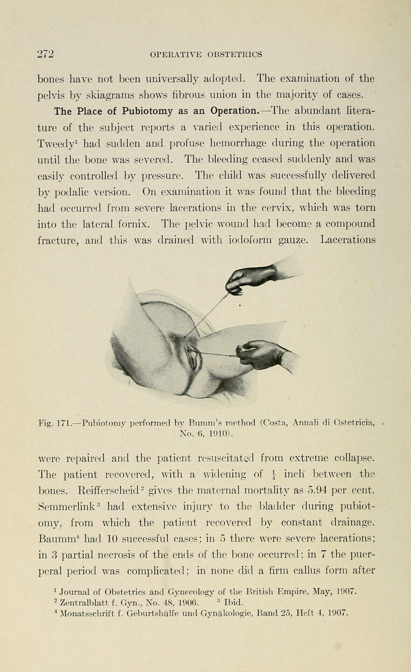 bones have not been universally adopted. The examination of the pelvis by skiagrams shows fibrous union in the majority of cases. The Place of Pubiotomy as an Operation.—The abundant litera- ture of the subject reports a varied experience in this operation. Tweedy^ had sudden and profuse hemorrhage during the operation until the bone was severed. The bleeding ceased suddenly and was easily controlled by pressure. The child was successfully delivered by podalic version. On examination it was found that the bleeding had occurred from severe lacerations in the cervix, which was torn into the lateral fornix. The pelvic wound had become a compound fracture, and this was drained with iodoform gauze. Lacerations Fig. 171.—Pubiotomy performed by Bumm's method (Costa, Annali di Ostetricia, No. 6, 1910). were repaired and the patient resuscitated from extreme collapse. The patient recovered, with a widening of \ inch between the bones. Reifferscheid ^ gives the maternal mortality as 5.94 per cent. SemmerHnk^ had extensive injury to the bladder during pubiot- omy, from which the patient recovered by constant drainage. Baumm' had 10 successful cases; in 5 there were severe lacerations; in 3 partial necrosis of the ends of the bone occurred; in 7 the puer- peral period was complicated; in none did a firm callus form after ^ Journal of Obstetrics and Gynecology of the British Empire, May, 1907. 2 Zentralblatt f. Gyn., No. 48, 1906. ^ Ibid. * Monatsschrift f. Geburtshulfe und Gynakologie, Band 25, Heft 4, 1907.