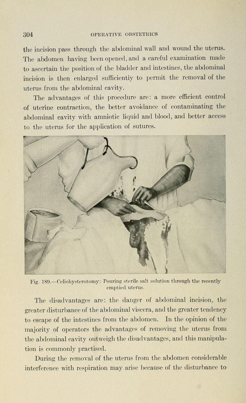 the incision pass through the abdominal wall and wound the uterus. The abdomen having been opened, and a careful examination made to ascertain the position of the bladder and intestines, the abdominal incision is then enlarged sufficiently to permit the removal of the uterus from the abdominal cavity. The advantages of this procedure are: a more efficient control of uterine contraction, the better avoidance of contaminating the abdominal cavity with amniotic liquid and blood, and better access to the uterus for the application of sutures. Fig. 189.—Celiohysterotomy: Pouring sterile salt solution through the recently emptied uterus. The disadvantages are: the danger of abdominal incision, the greater disturbance of the abdominal viscera, and the greater tendency to escape of the intestines from the abdomen. In the opinion of the majority of operators the advantages of removing the uterus from the abdominal cavity outweigh the disadvantages, and this manipula- tion is commonly practised. During the removal of the uterus from the abdomen considerable interference with respiration may arise because of the disturbance to